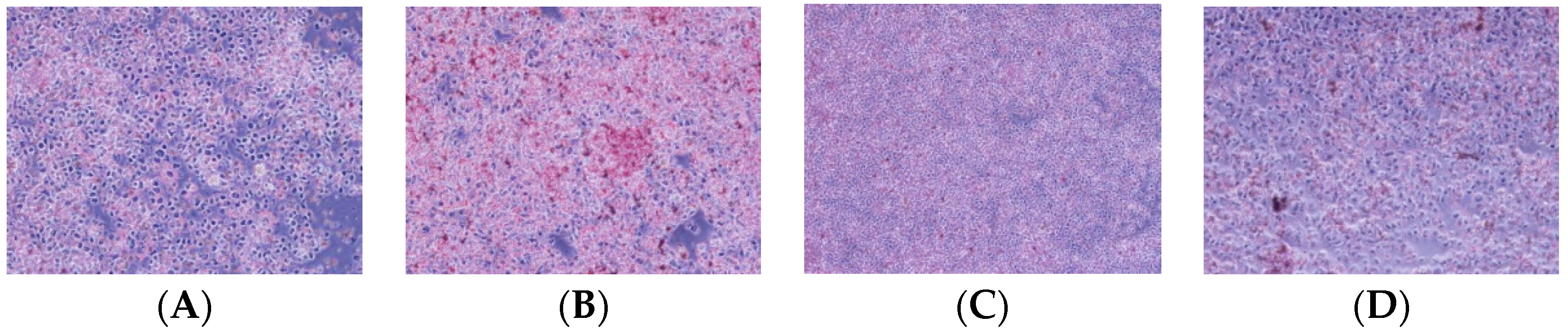 Ijms Free Full Text Inhibitory Effect Of Gardenoside On Free Fatty Acid Induced Steatosis In Hepg2 Hepatocytes Html