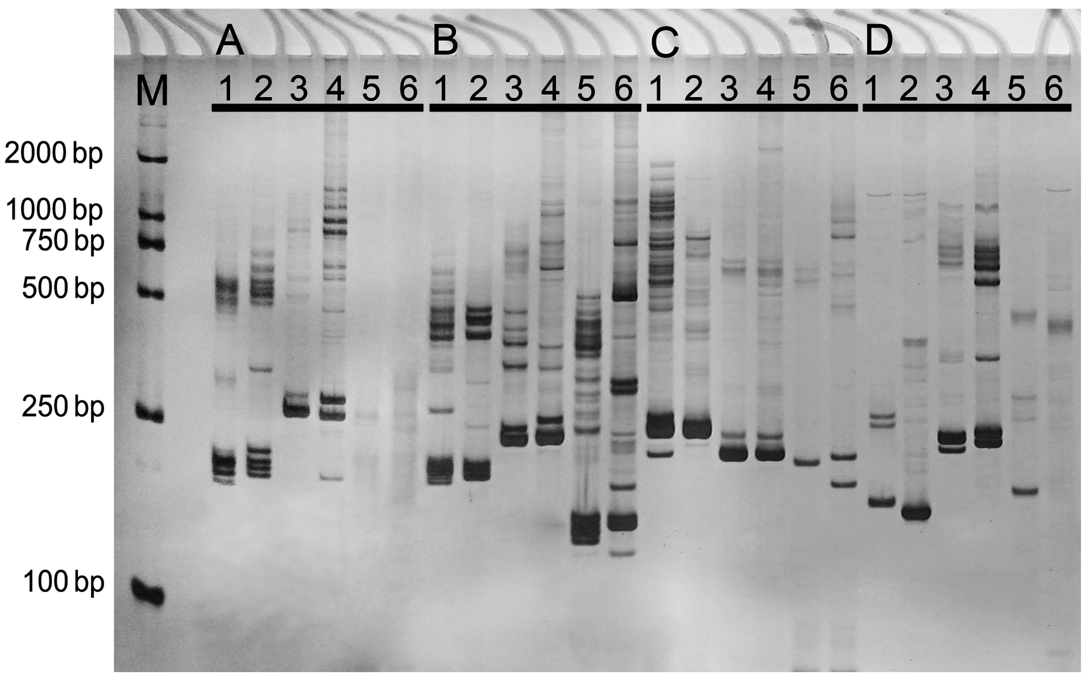 IJMS Free FullText De Novo Transcriptome Sequencing