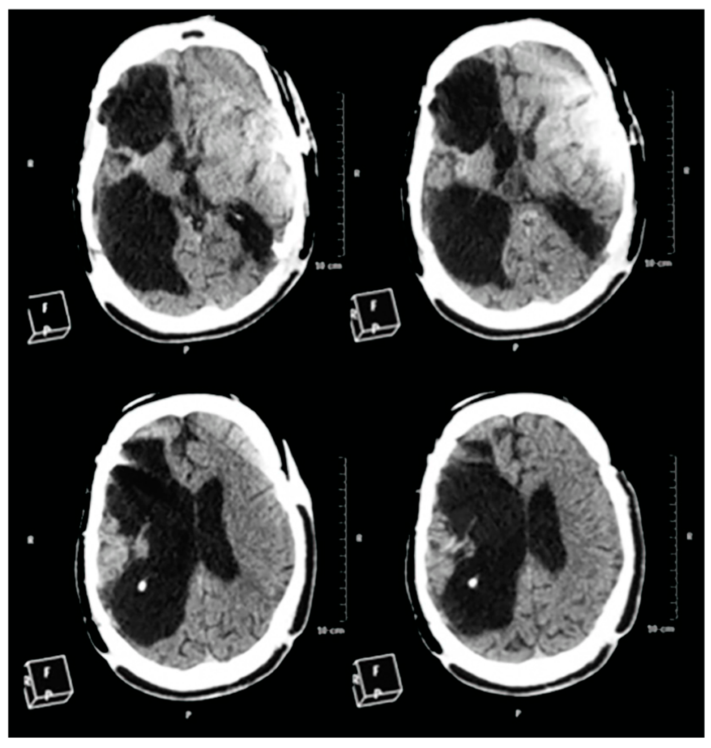 Ijms 16 26244 g006 1024