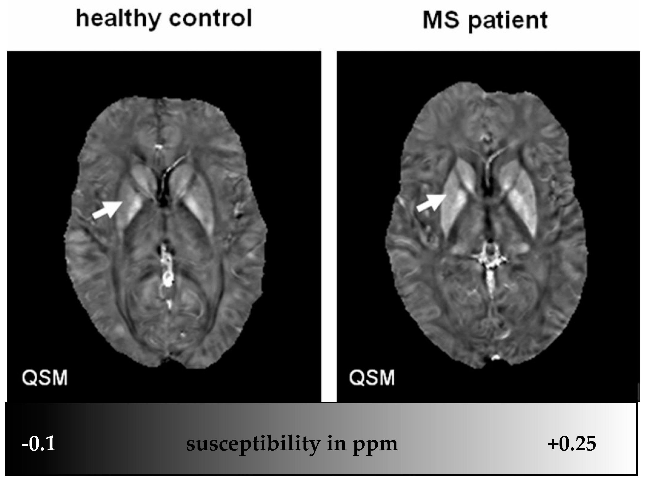 Ijms 17 00100 g002