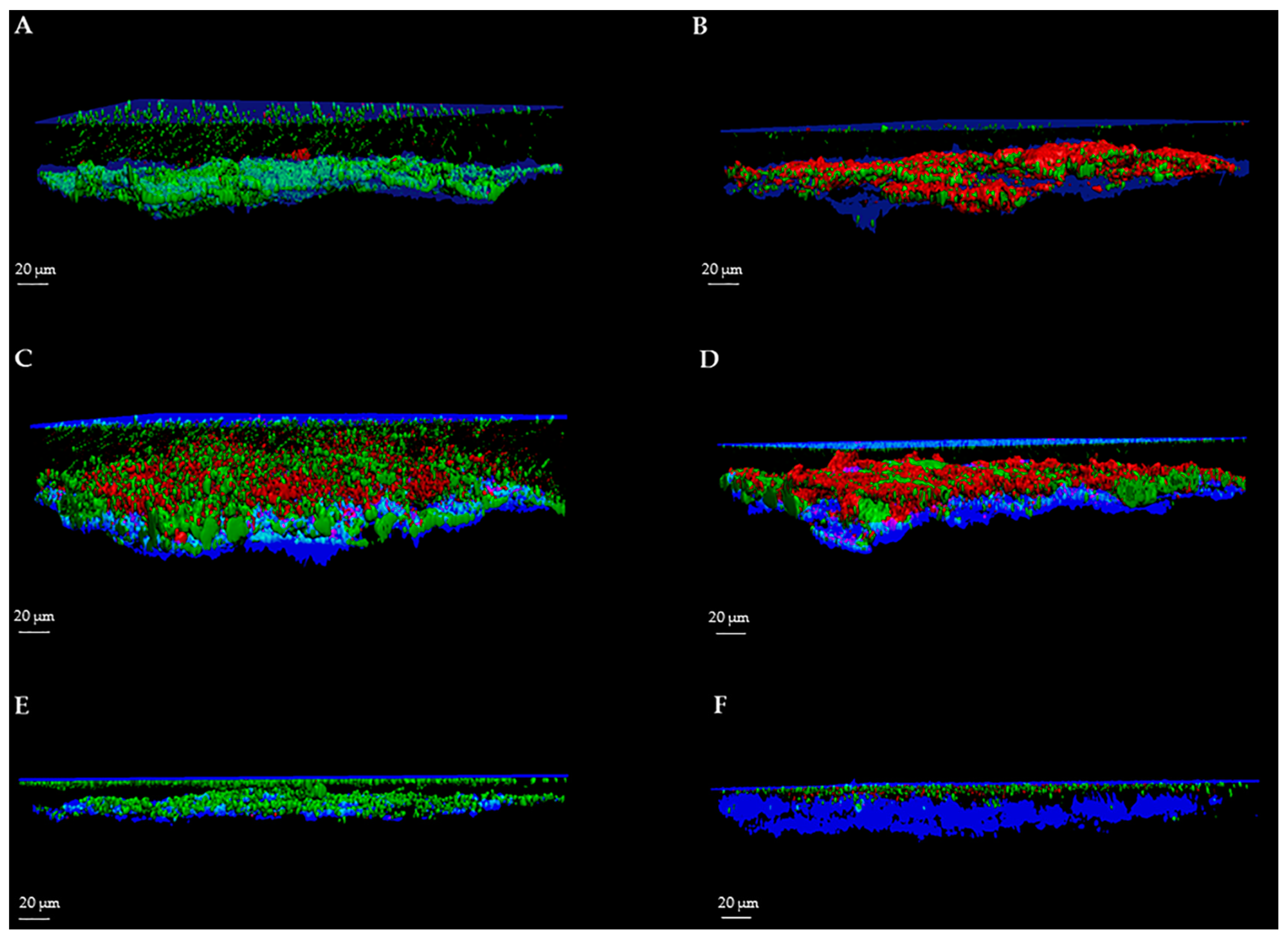 Ijms Free Full Text How To Study Biofilms After