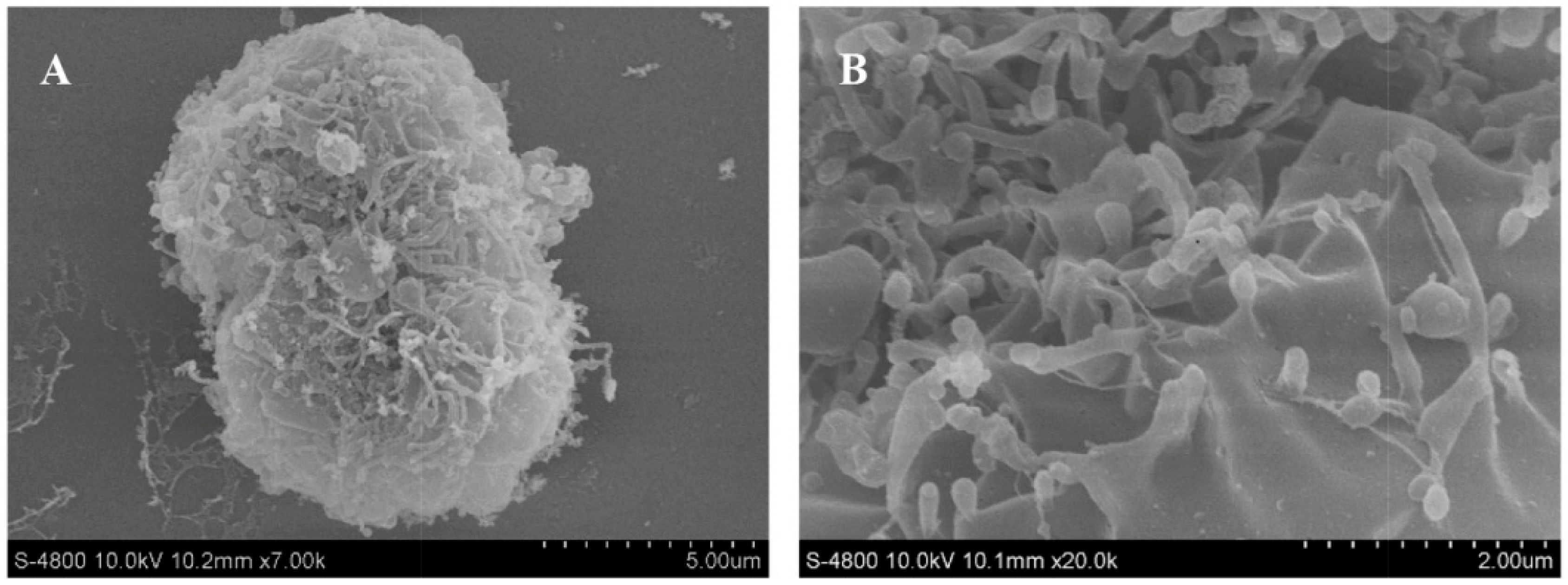 Ijms 17 00335 g004a 1024