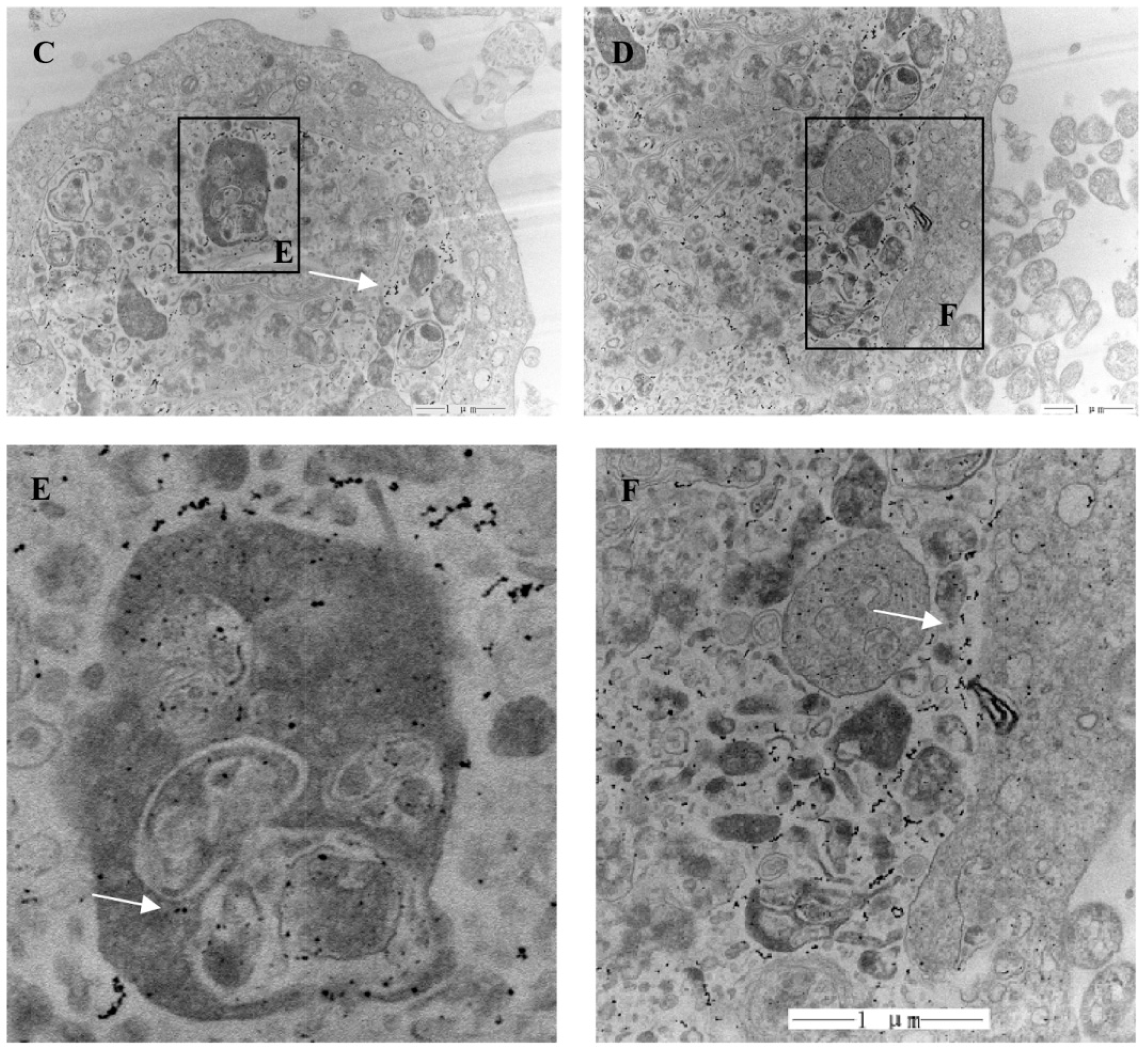 Ijms 17 00335 g004b 1024