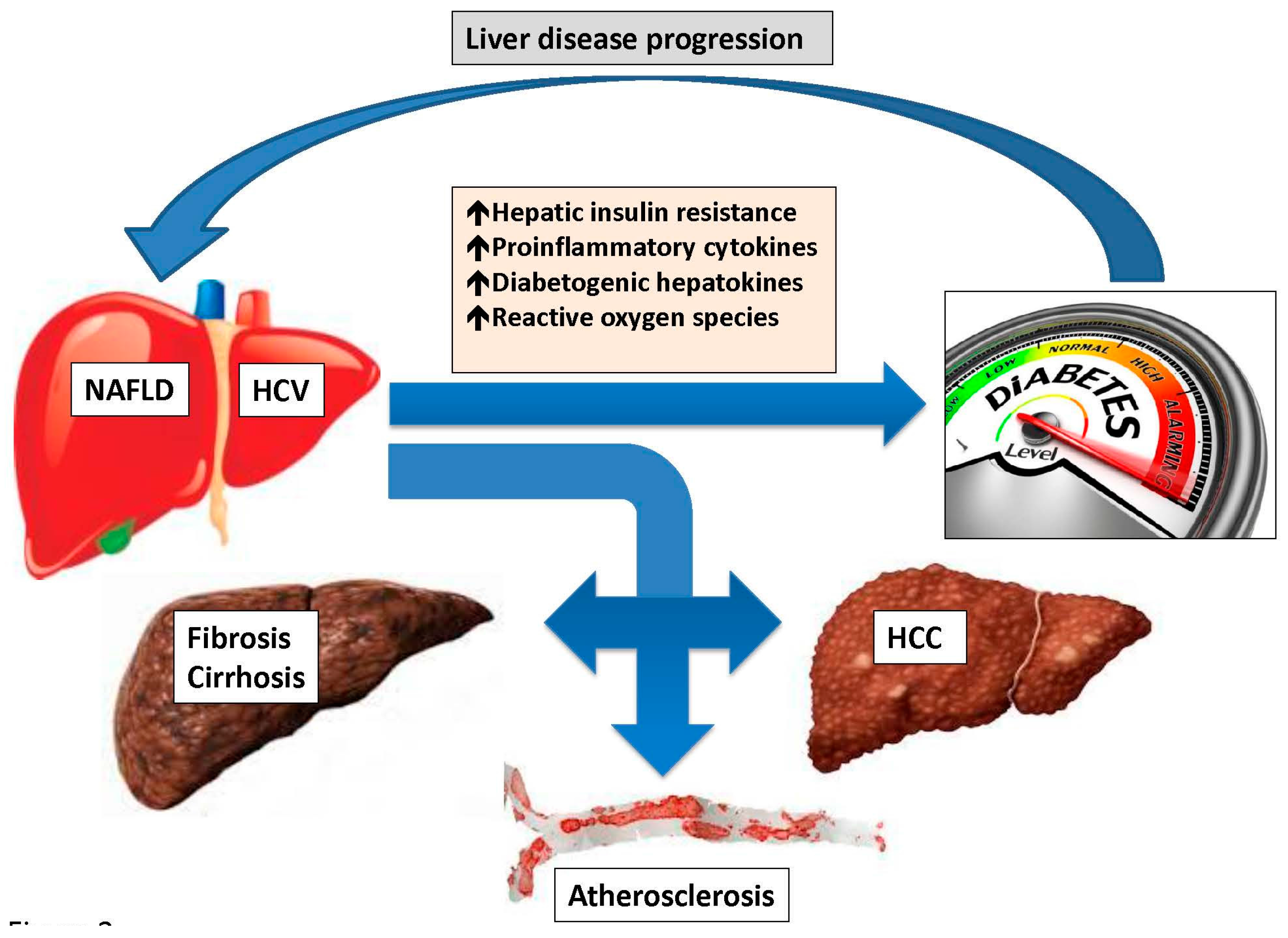 Fatty Liver Diabetes Type 2 DiabetesWalls