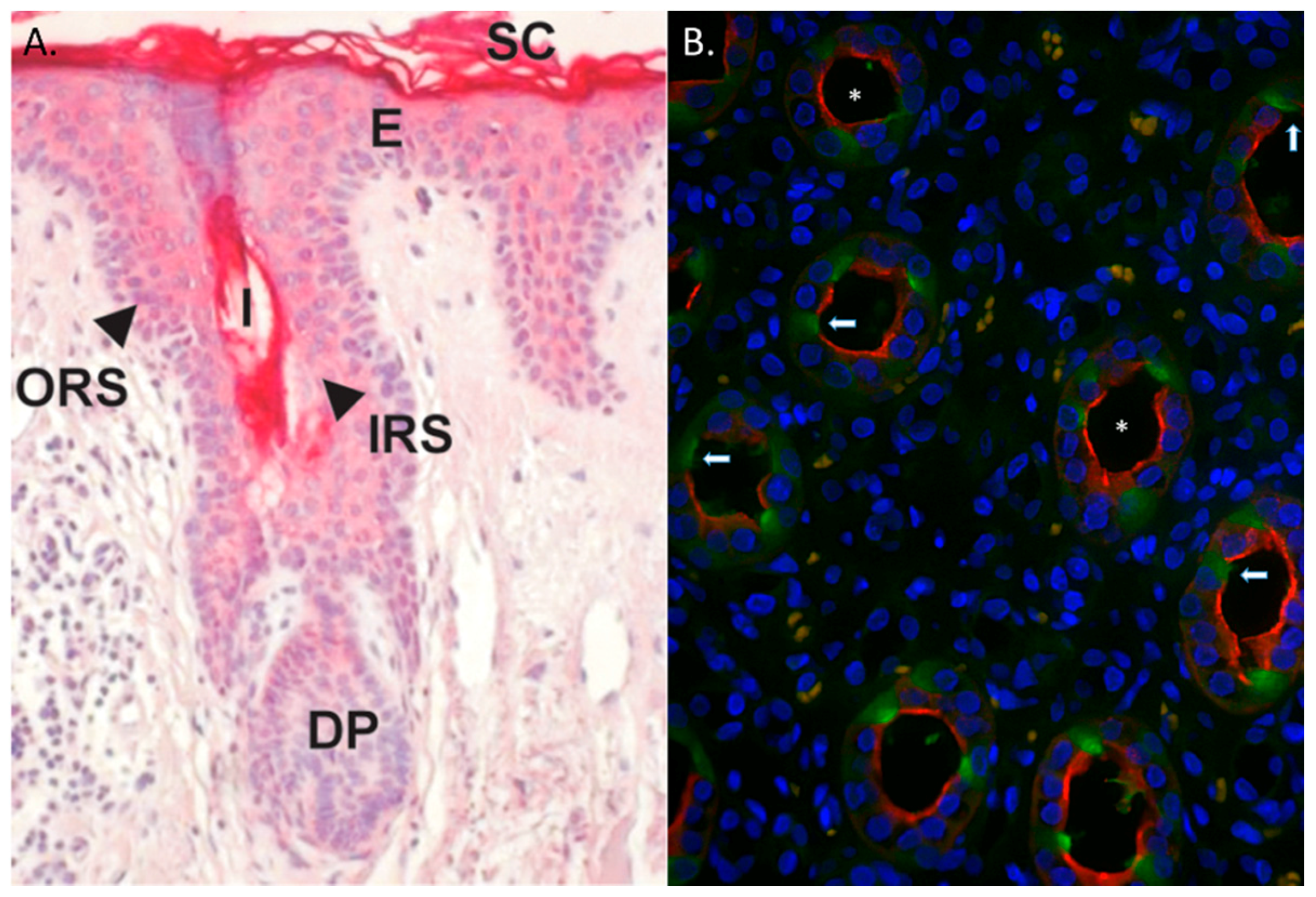 Ijms 17 00423 g003 1024