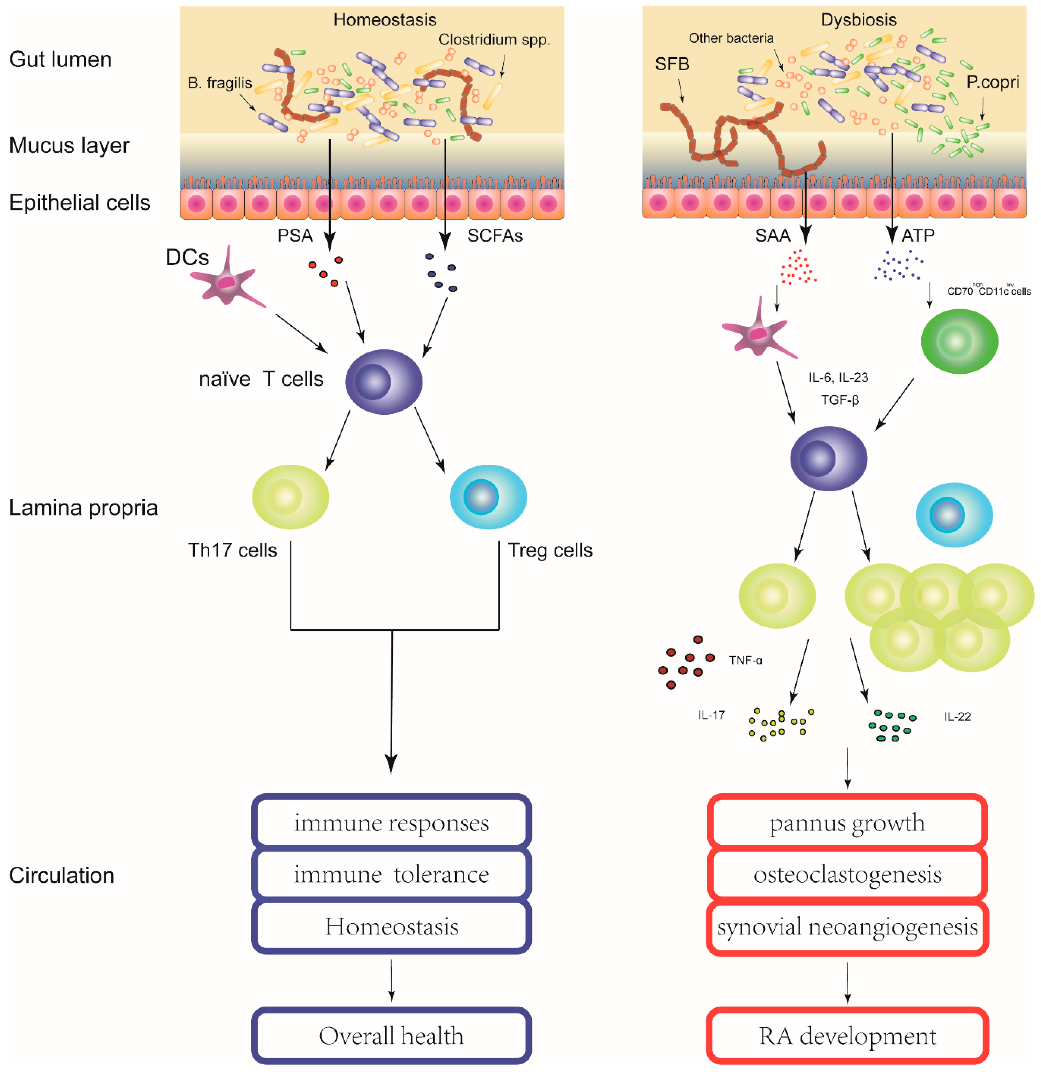 motor kradse Motel IJMS | Free Full-Text | Molecular Insight into Gut Microbiota and  Rheumatoid Arthritis | HTML