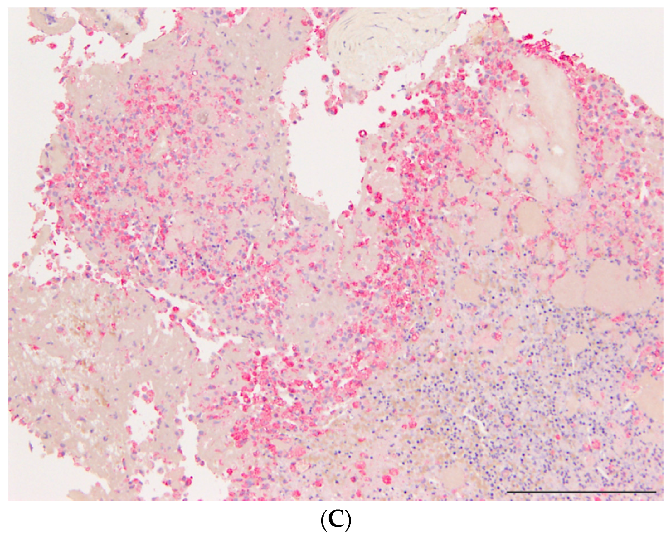 Ijms 17 00433 g004b 1024