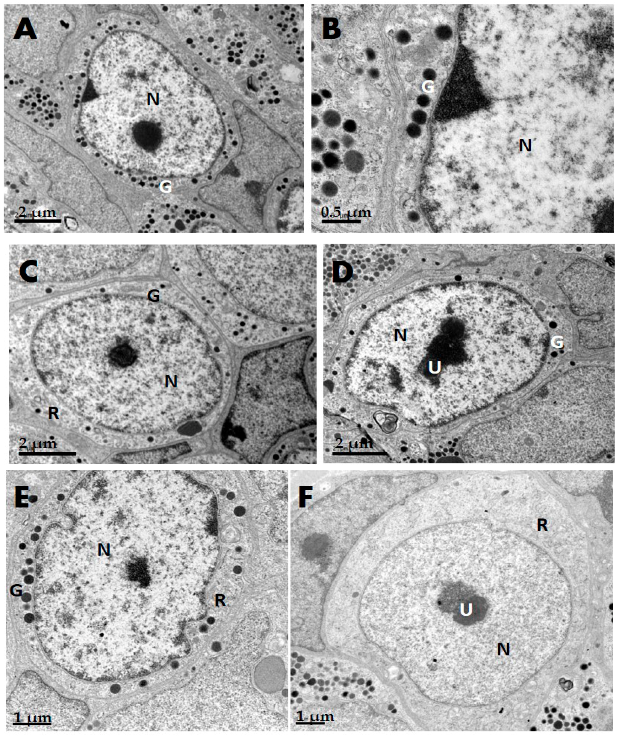 Ijms 17 00543 g001 1024