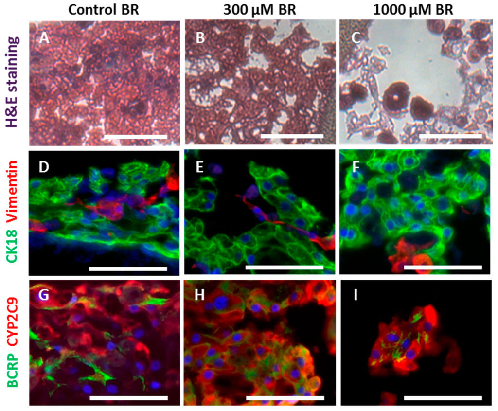 In Vitro Model for Hepatotoxicity Studies Based on Primary Human