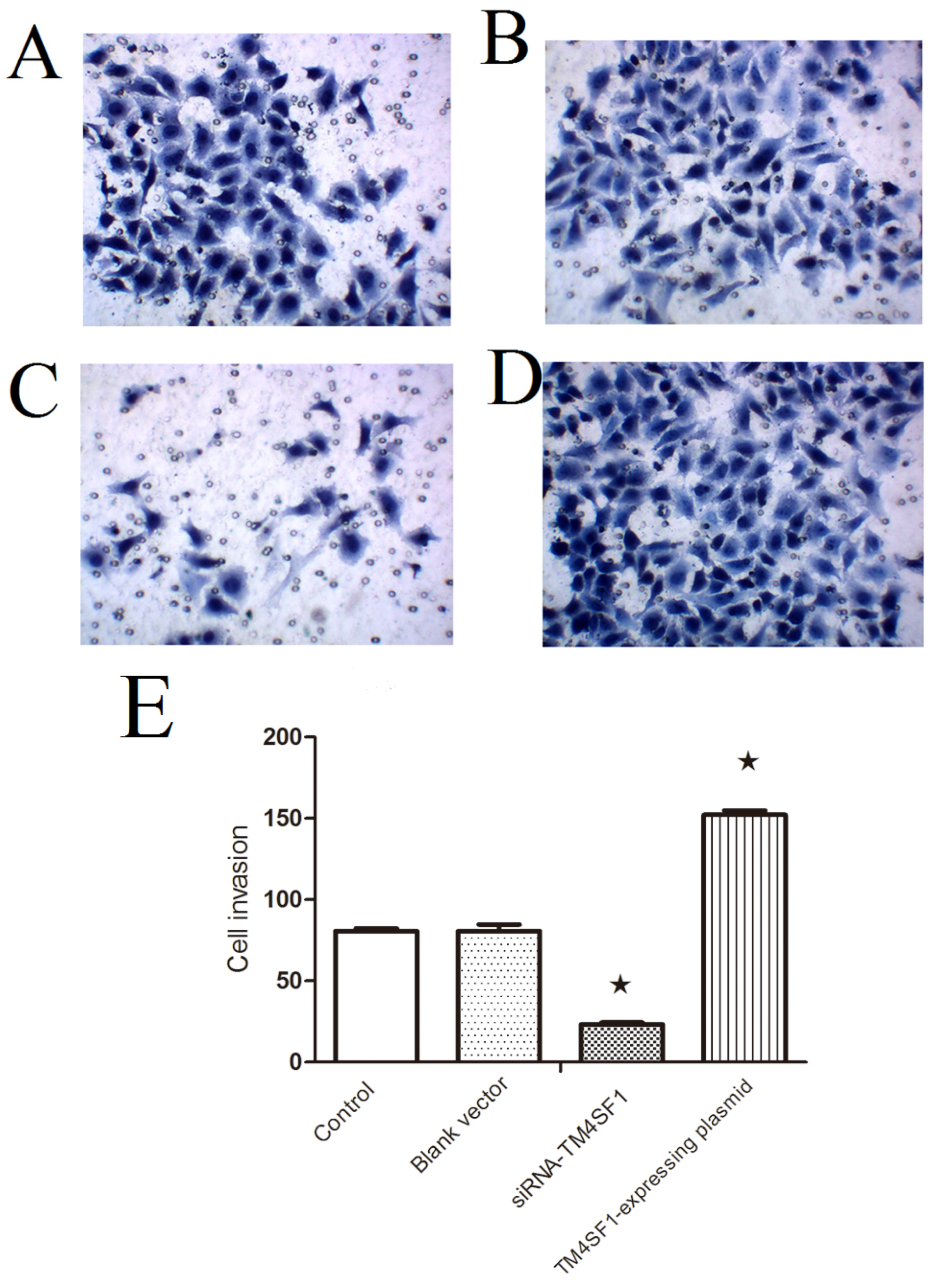 Ijms 17 00661 g002 1024