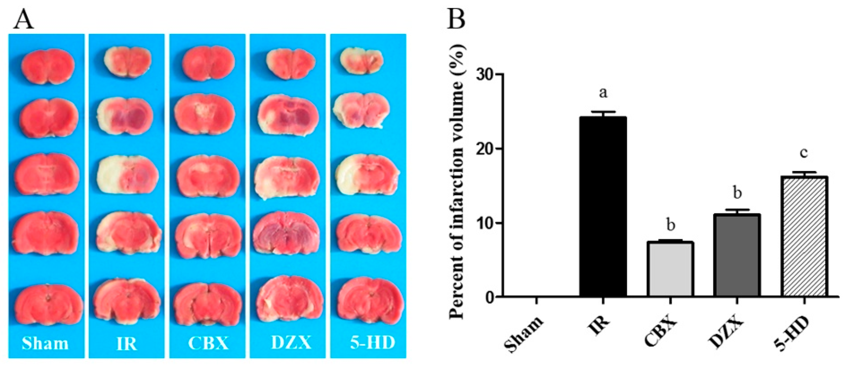 Ijms 17 00679 g001 1024