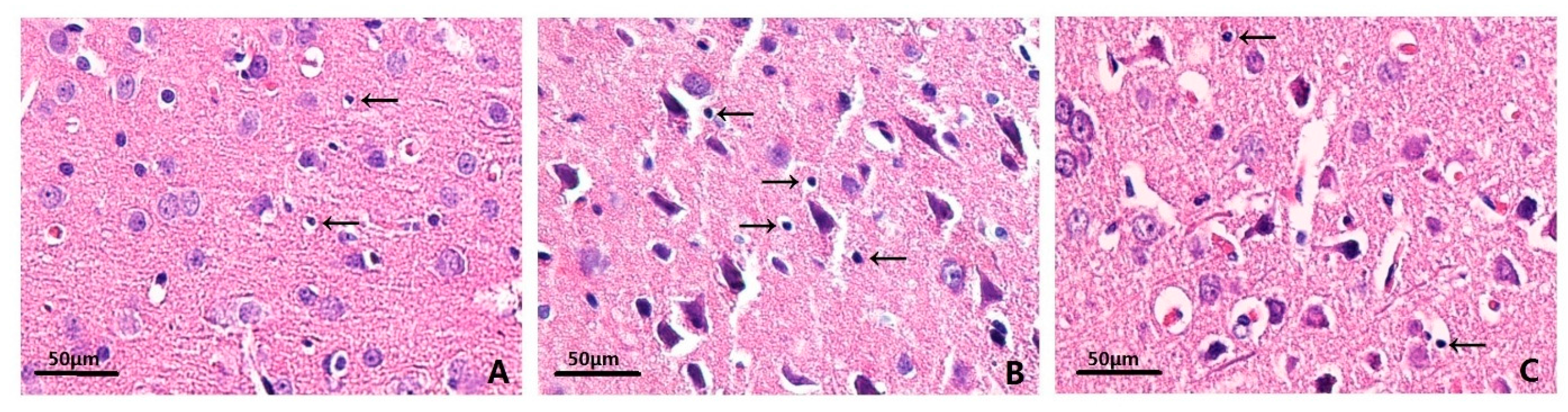 Ijms 17 00710 g002 1024