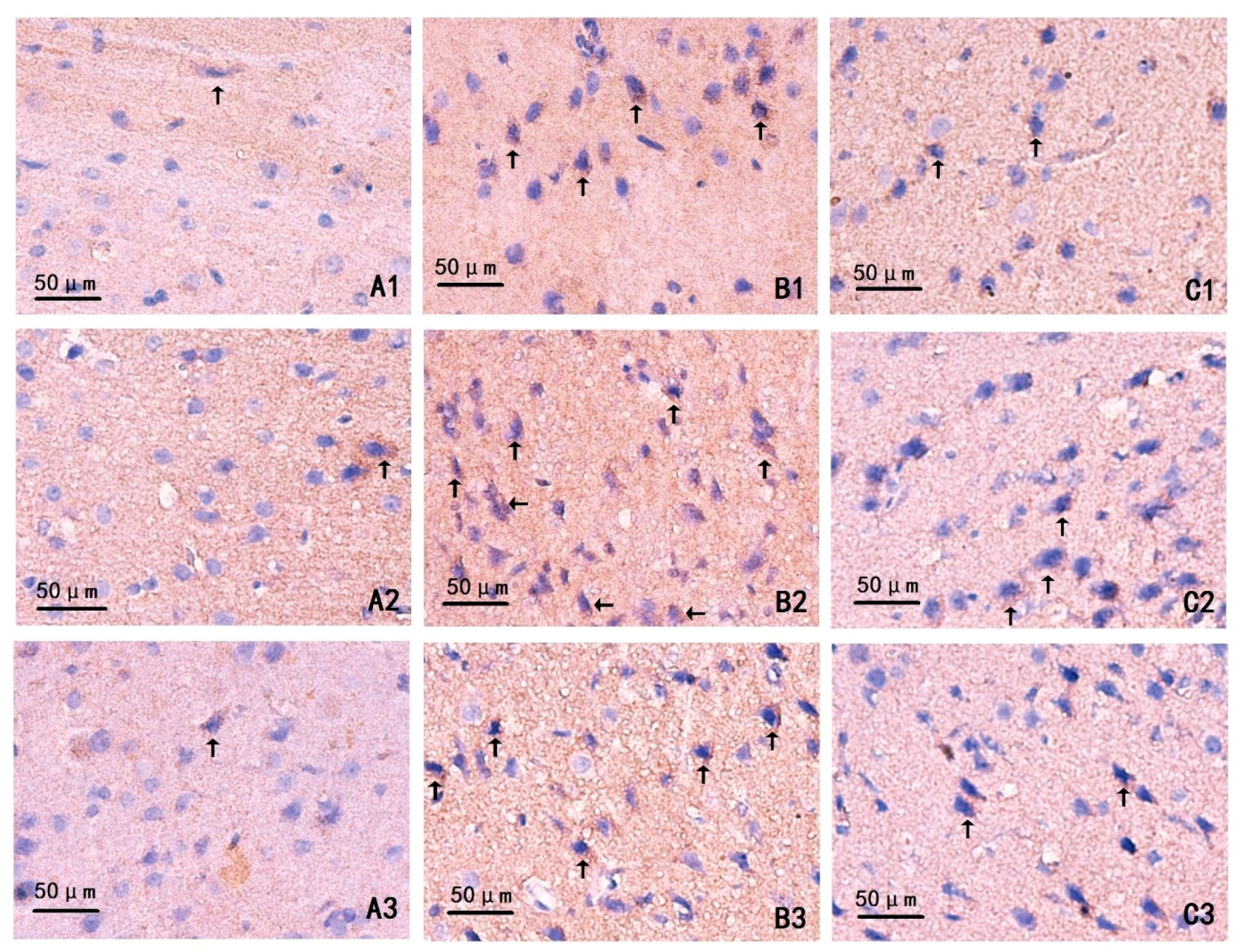 Ijms 17 00710 g003 1024