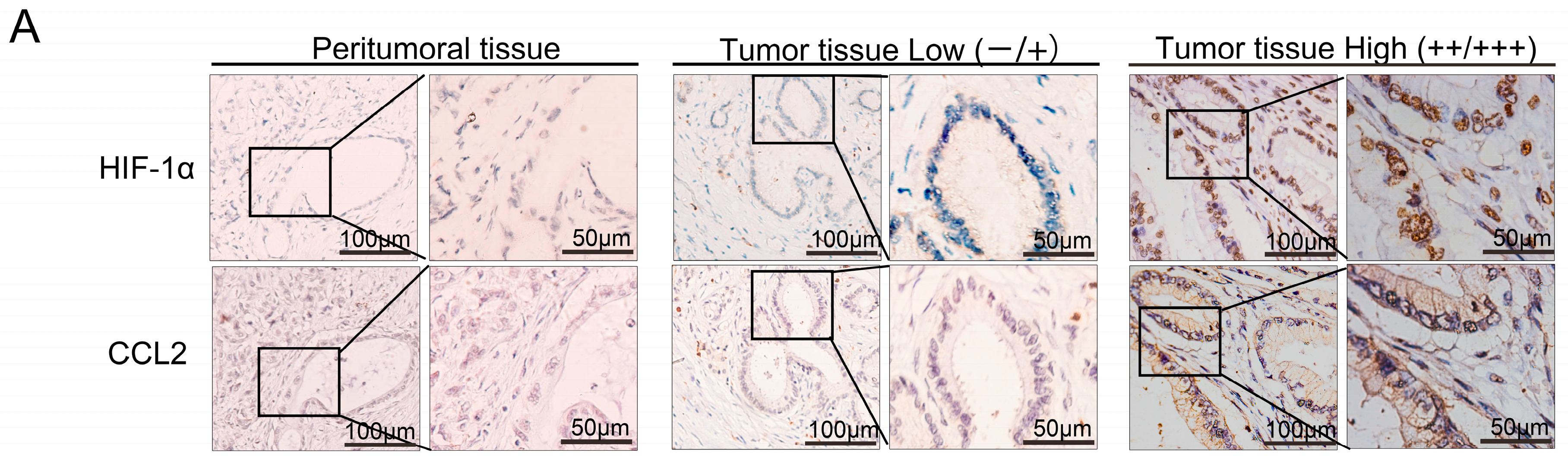 Ijms 17 00799 g002a 1024