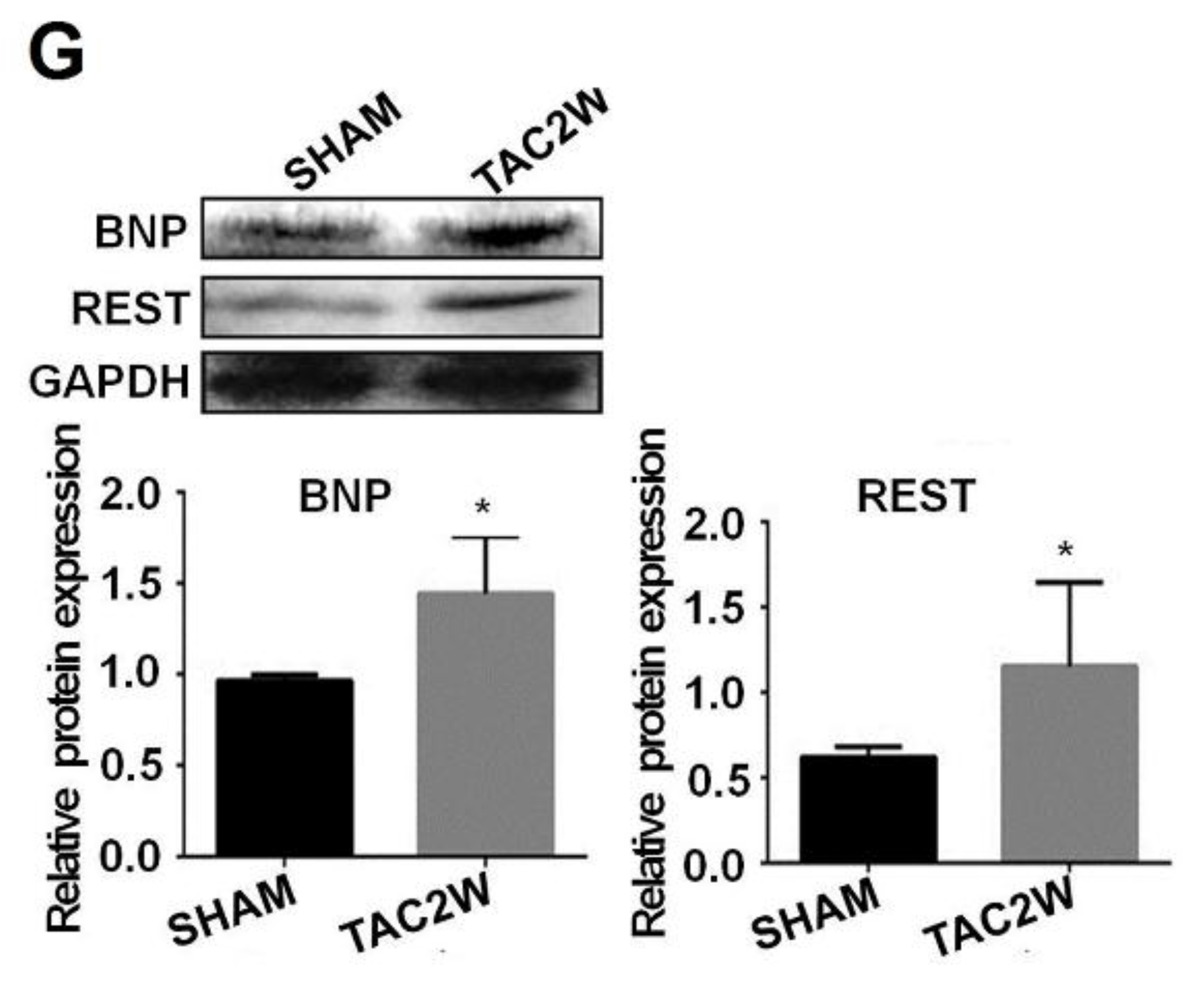 Ijms 17 00848 g003b 1024