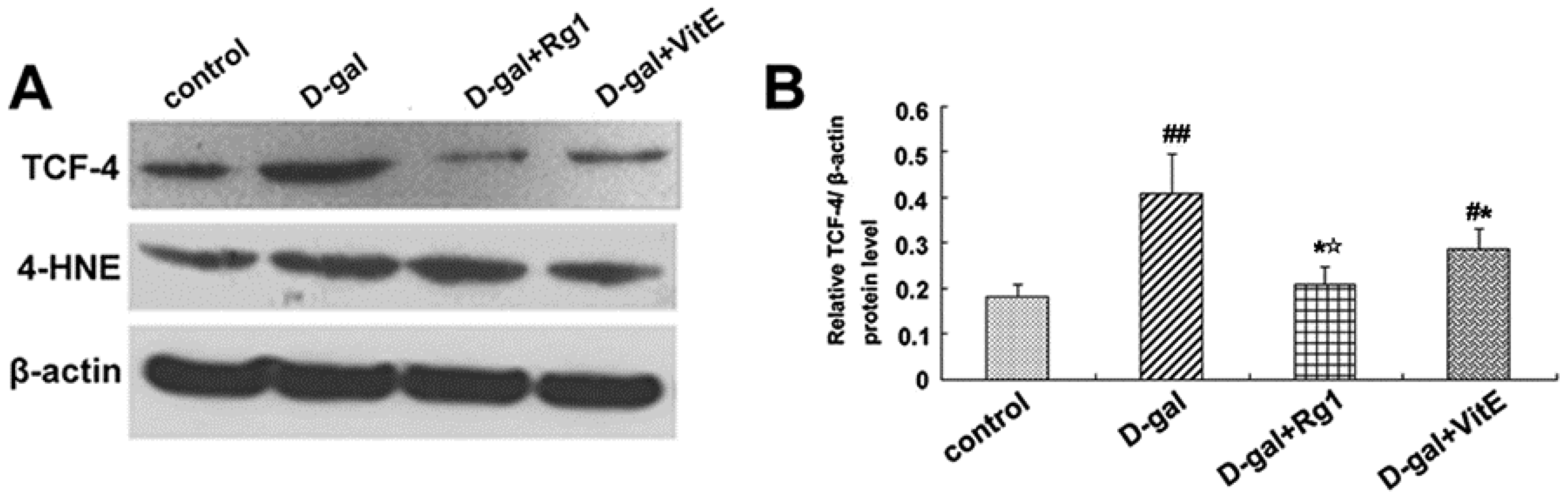 Ijms 17 00849 g005a 1024