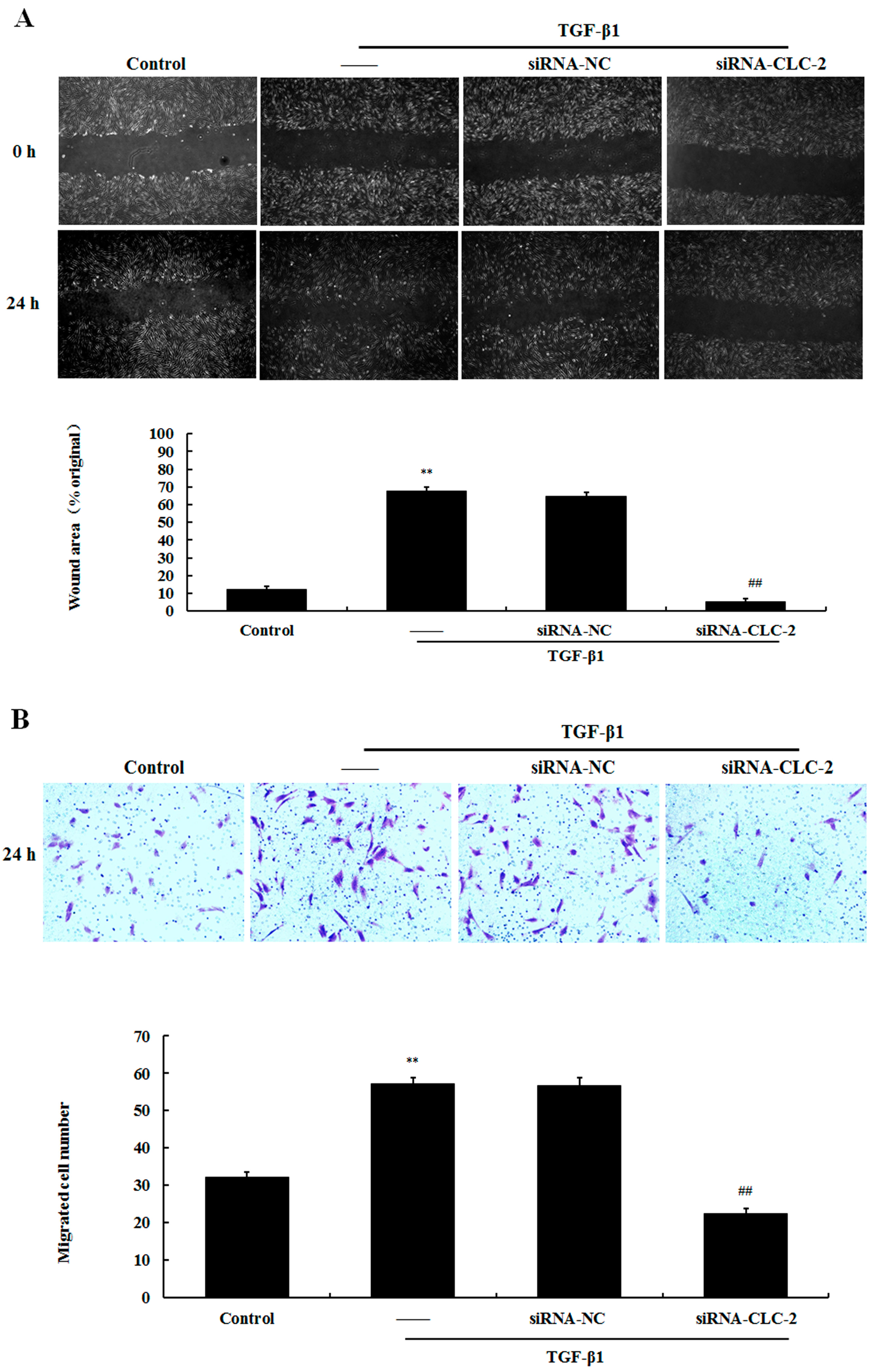 Ijms 17 00910 g004