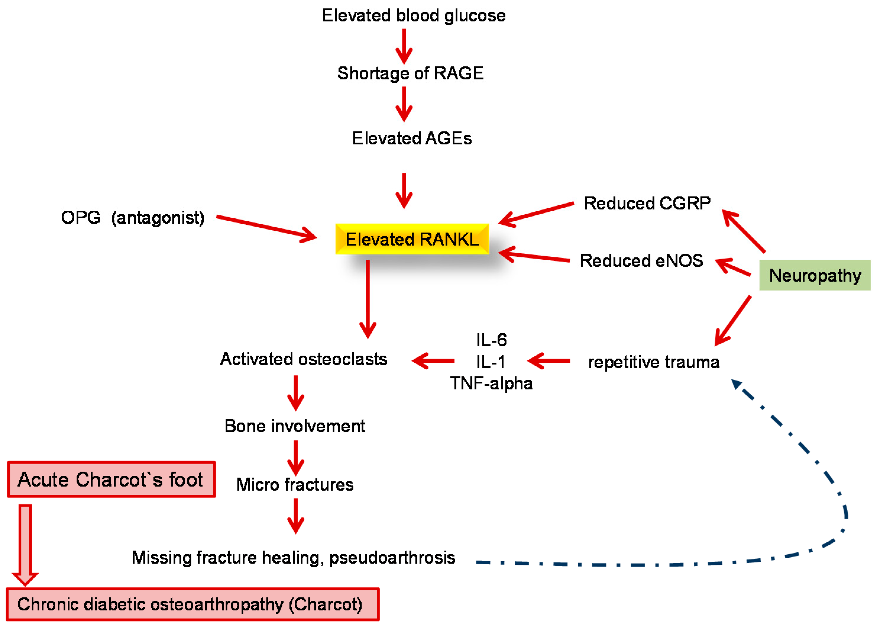 diabetic neuropathy pathophysiology)