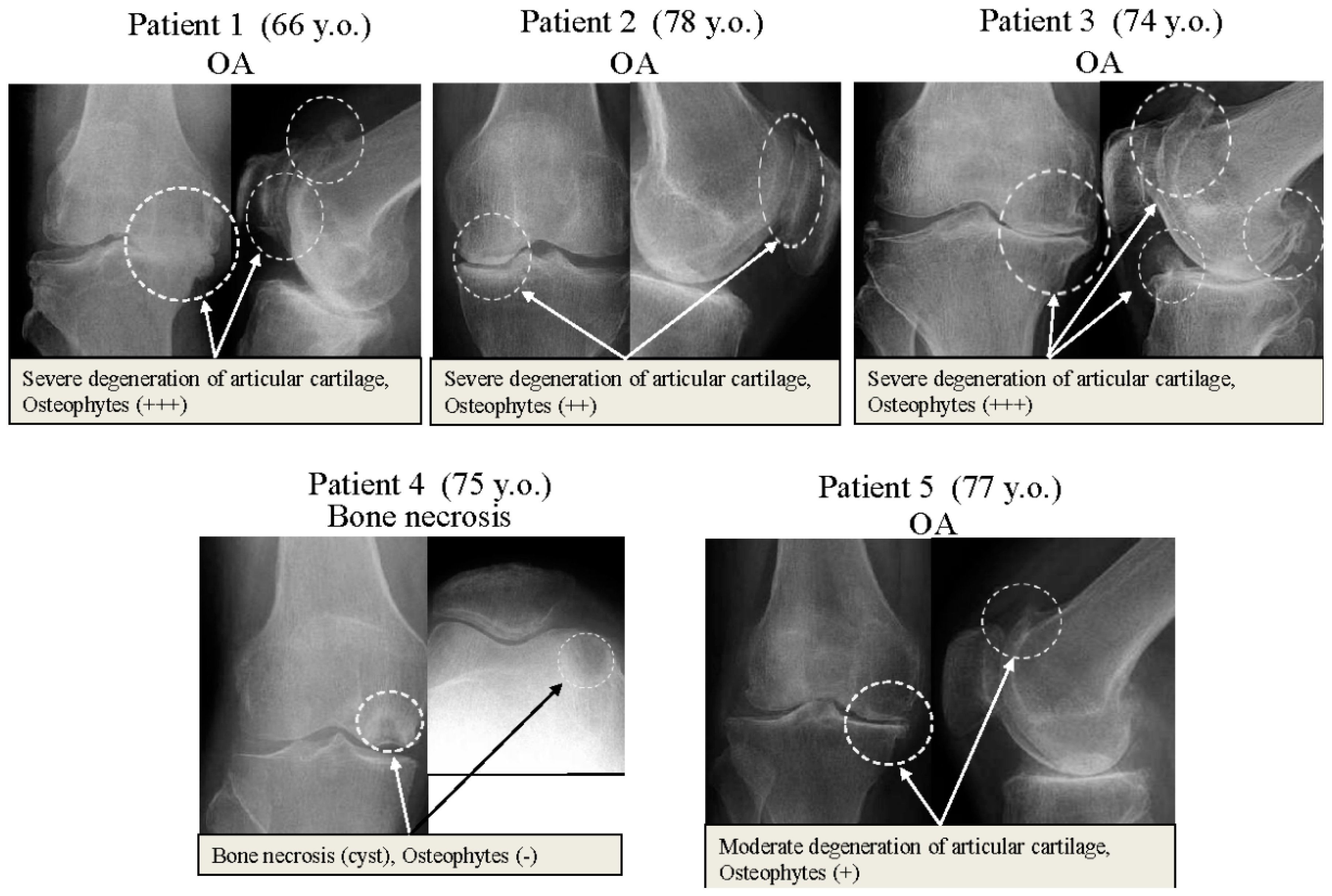 Ijms 17 01019 g001 1024