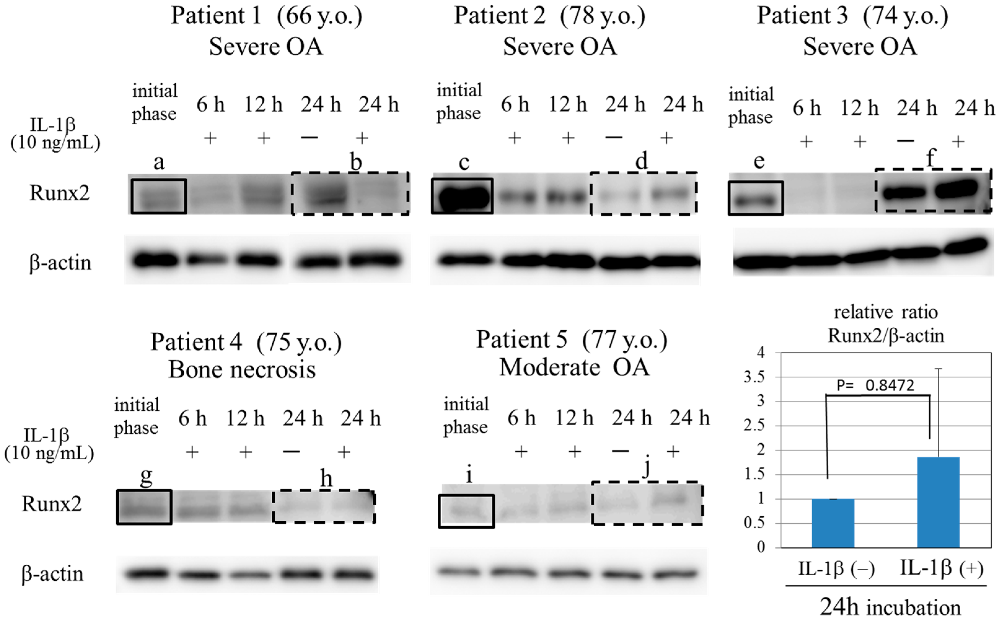Ijms 17 01019 g003 1024