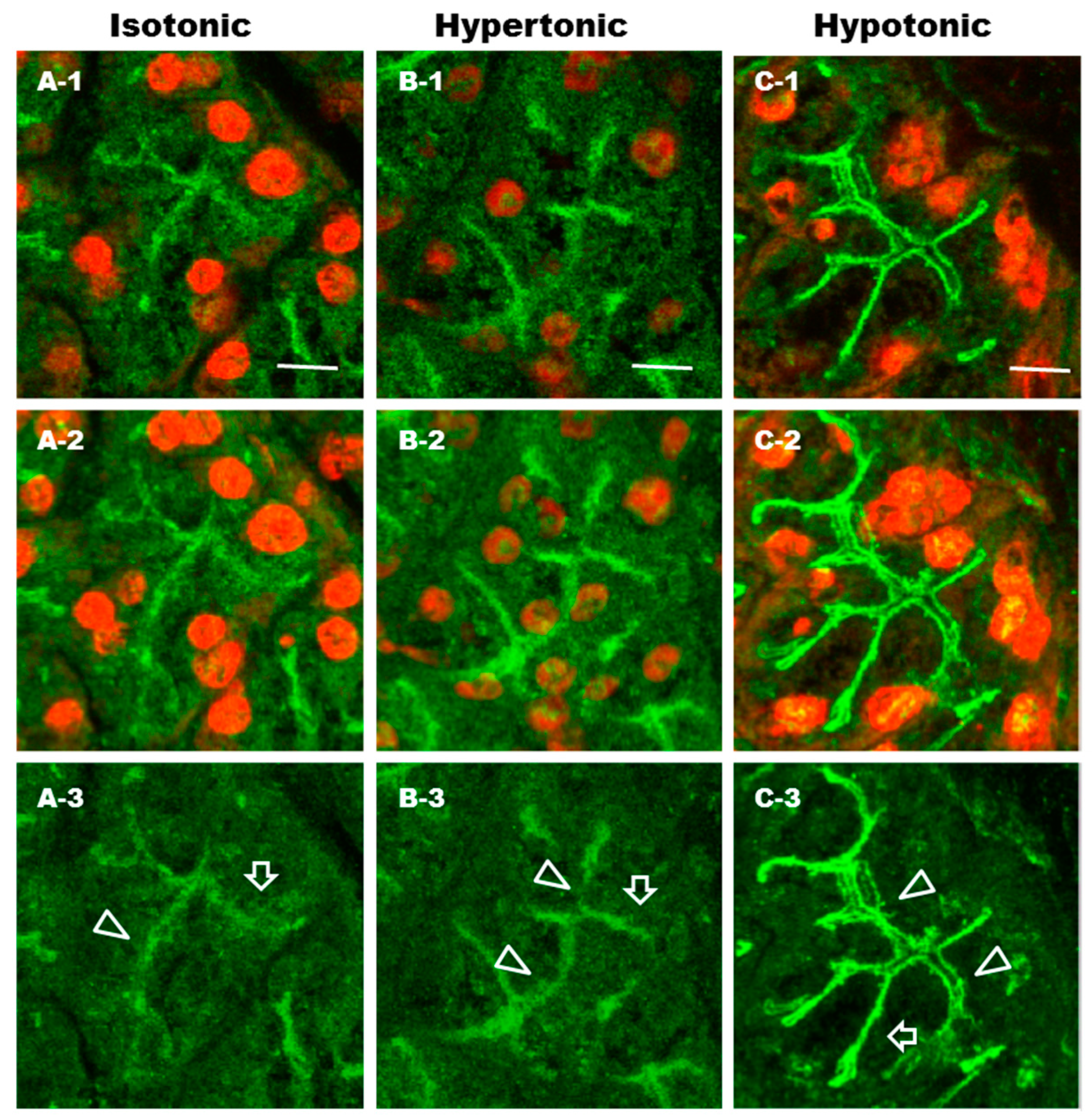 Ijms 17 01022 g007 1024