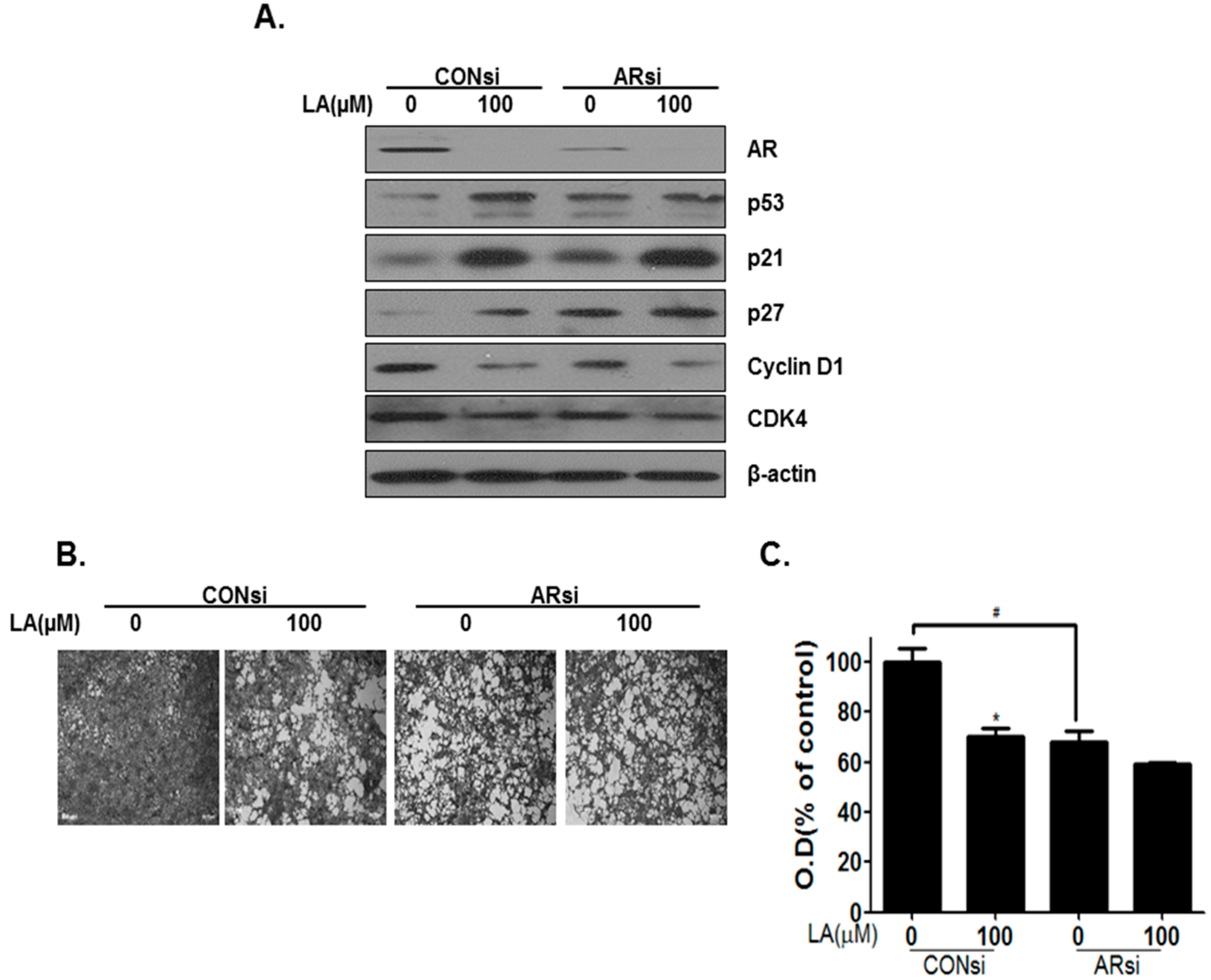Ijms 17 01066 g004 1024