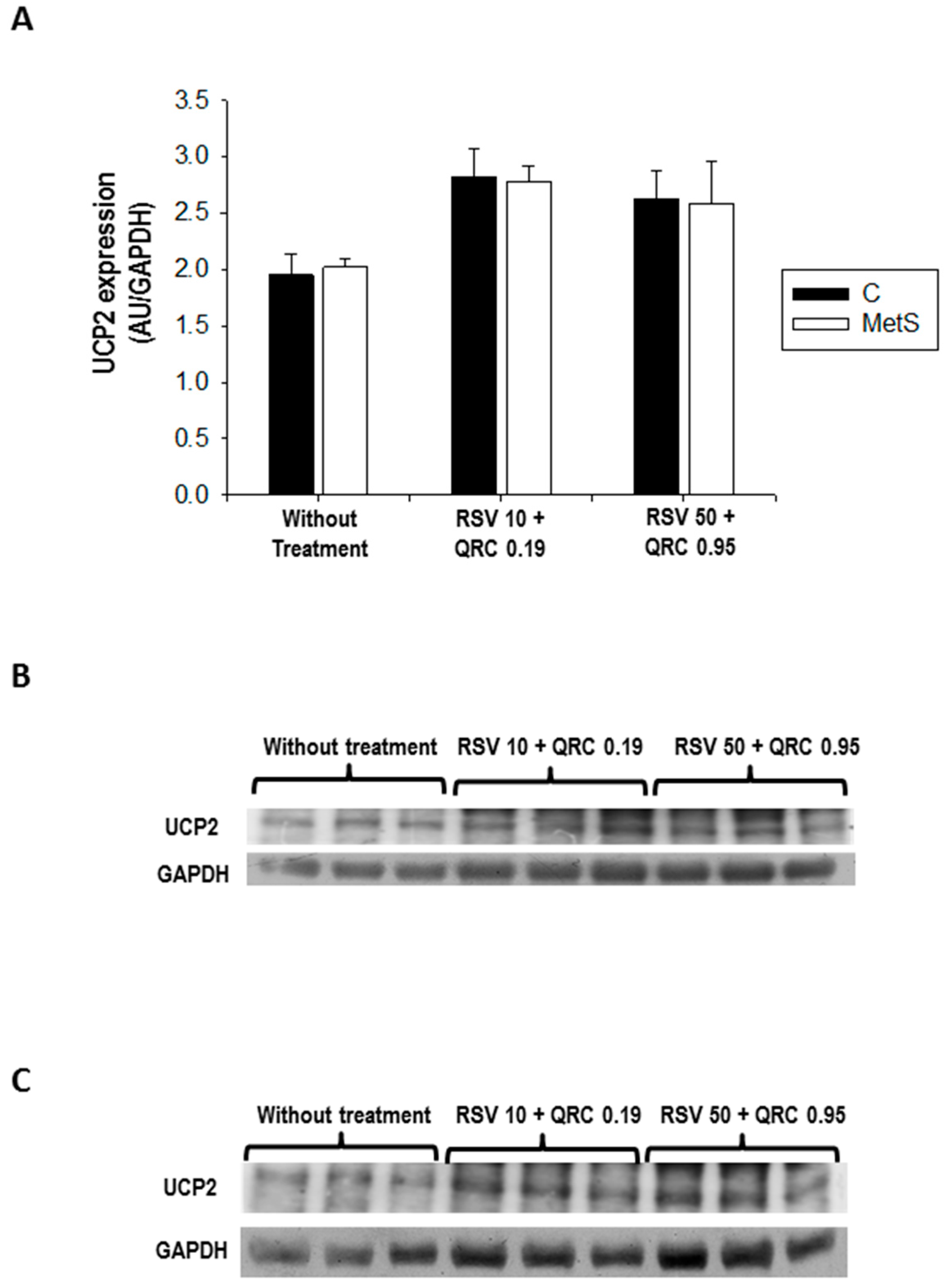Ijms 17 01069 g004 1024
