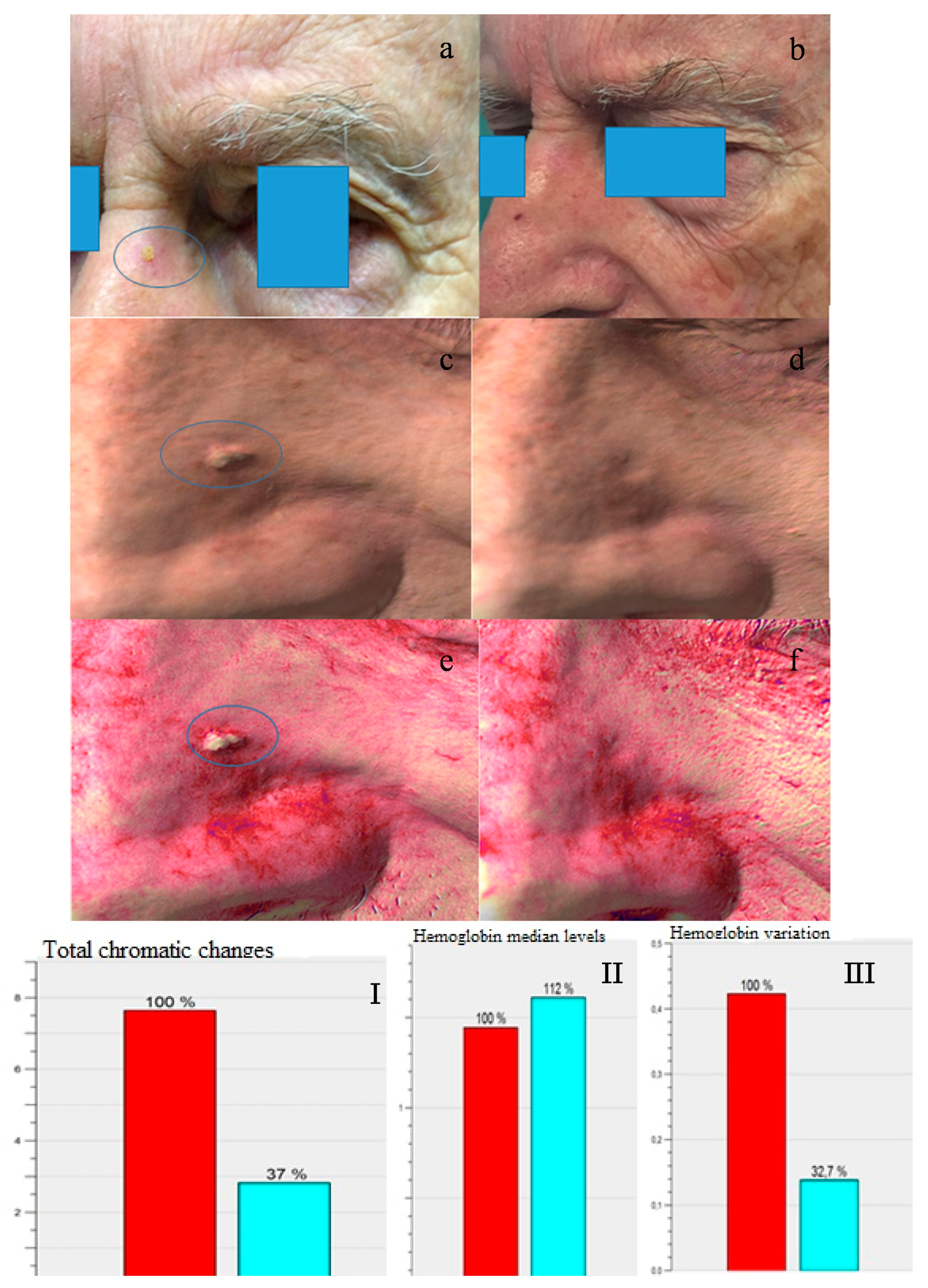 Ijms 17 01108 g002 1024