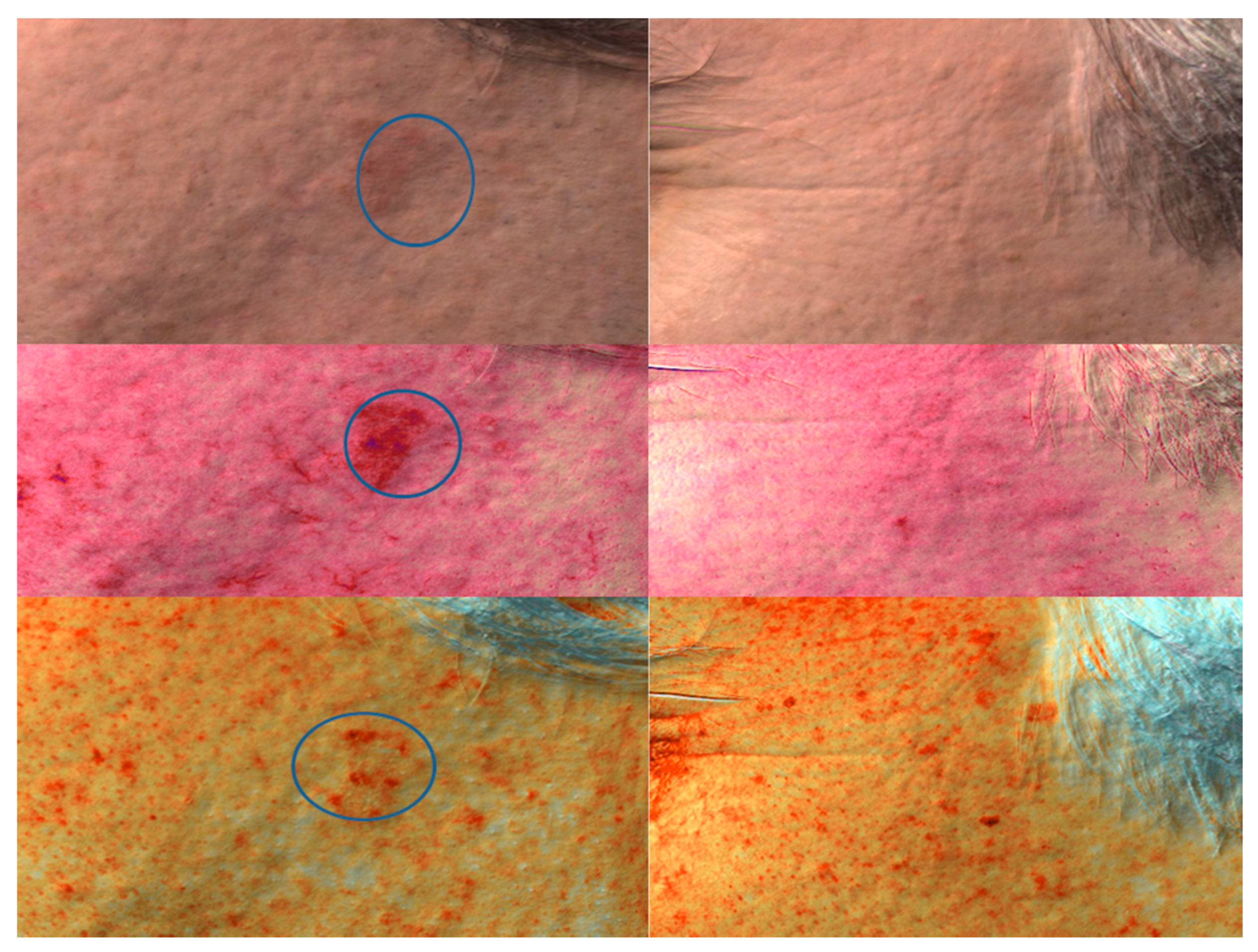 Ijms 17 01108 g004 1024