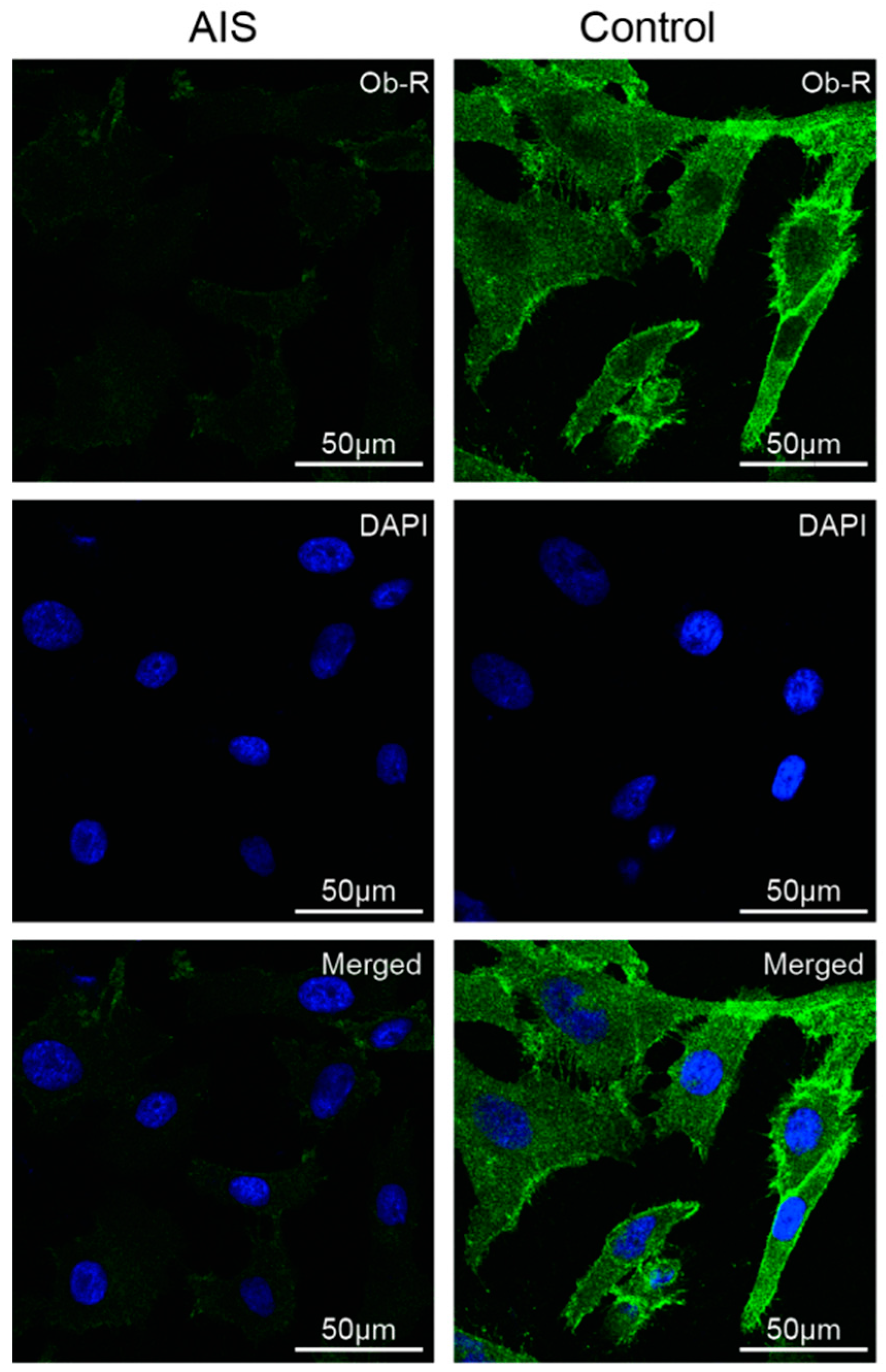 Ijms 17 01160 g002 1024