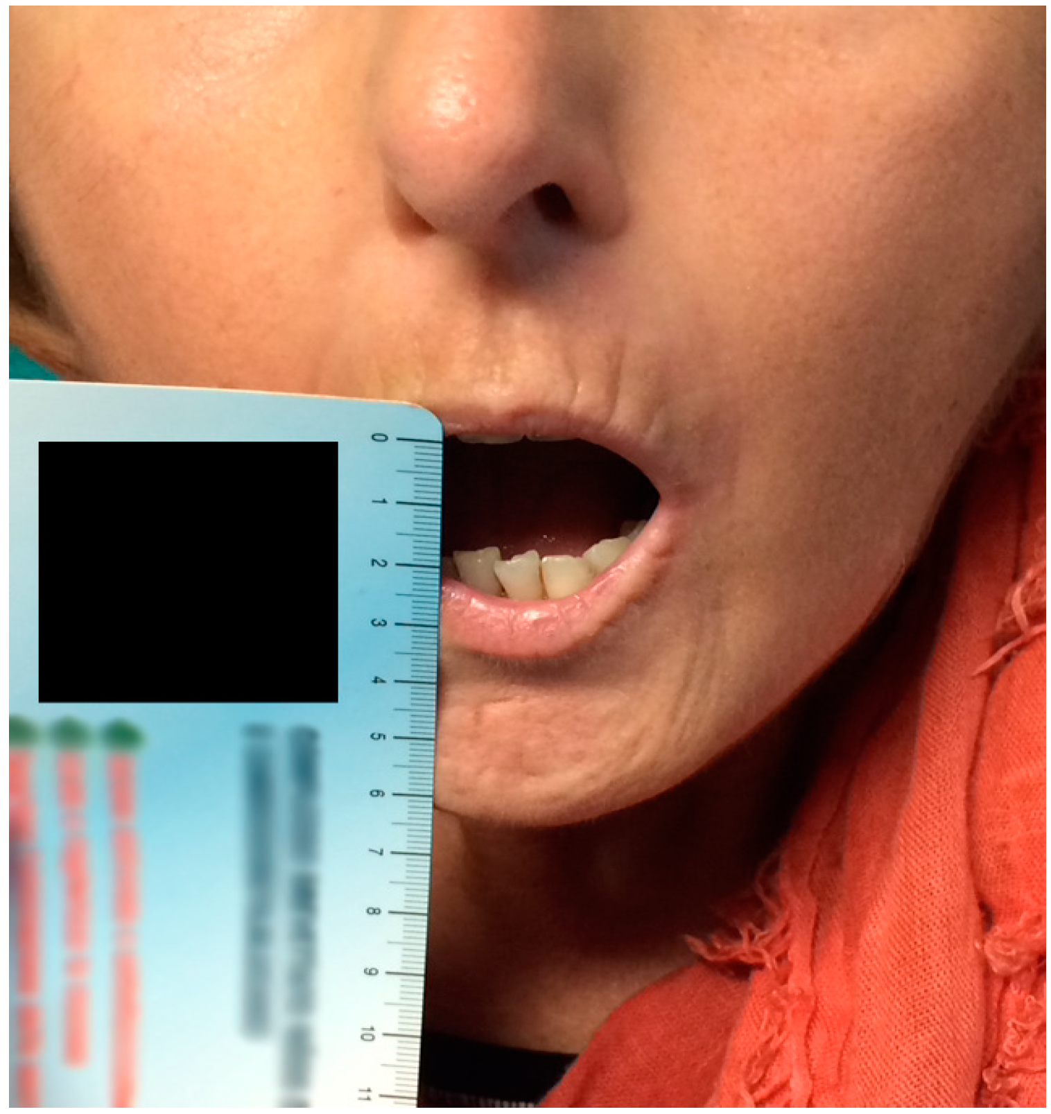 Ijms 17 01189 g003