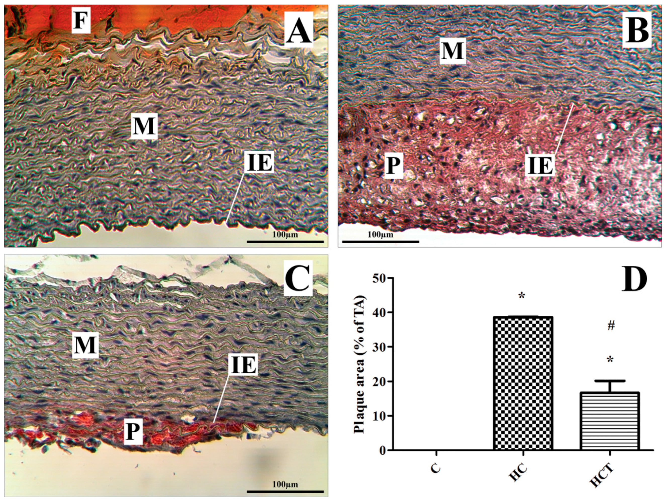 Ijms 17 01284 g004 1024