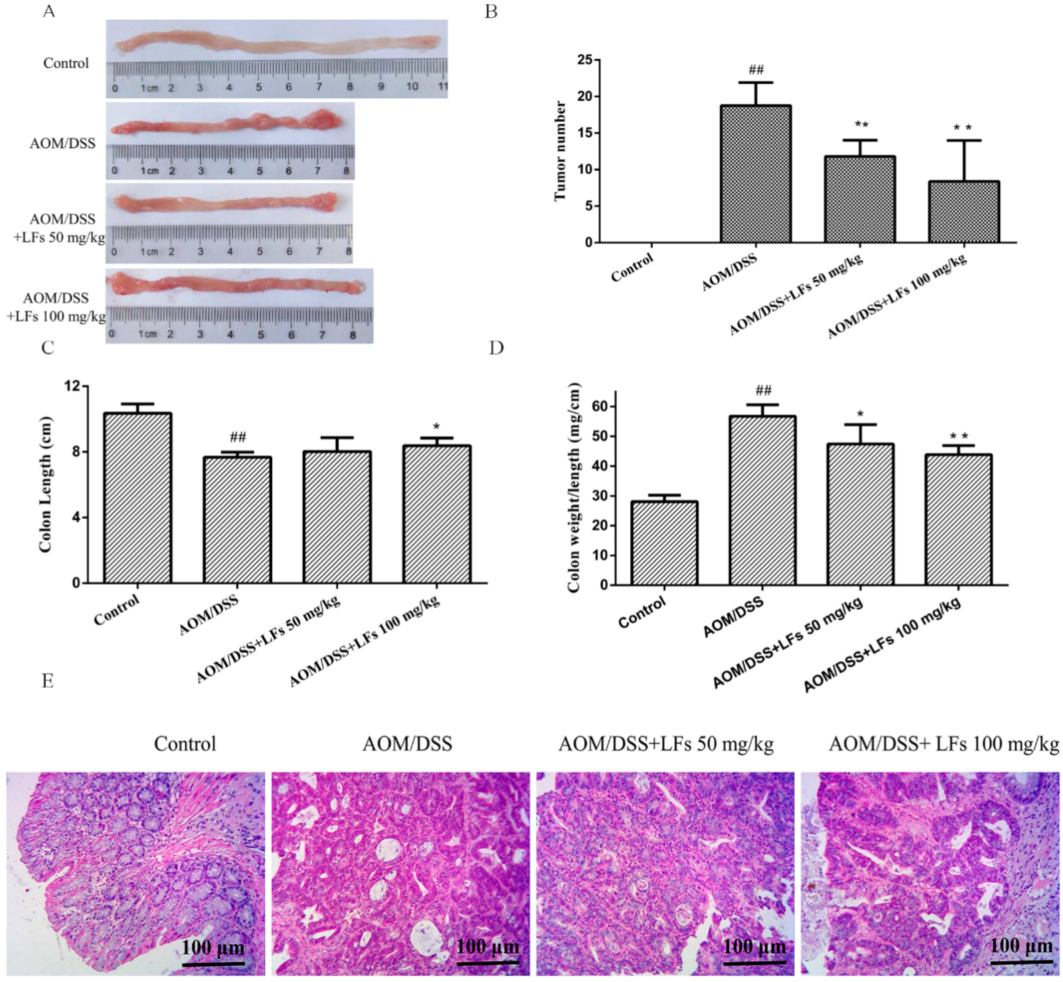Ijms 17 01343 g002 1024