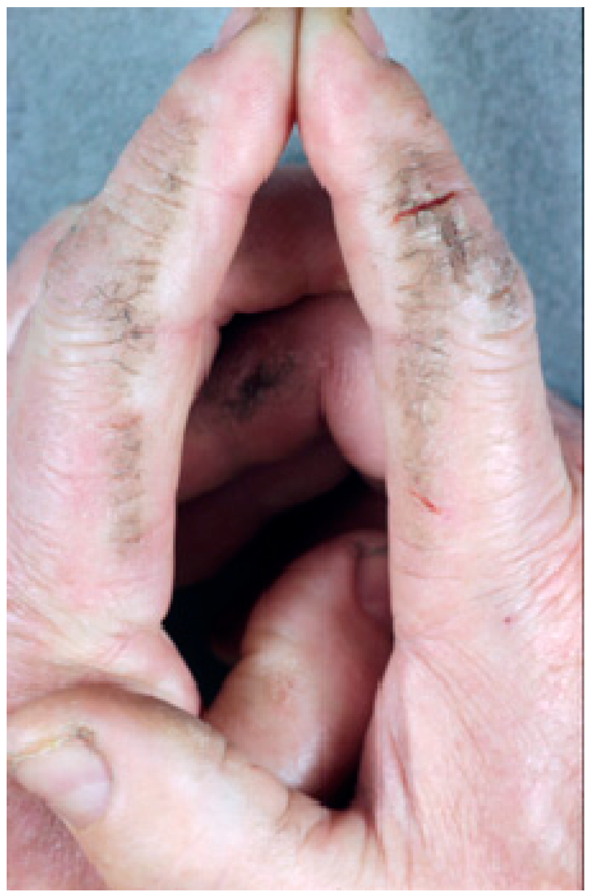 Ijms 17 01362 g001 1024