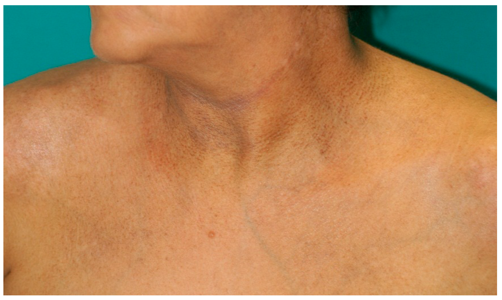 Ijms 17 01362 g002 1024