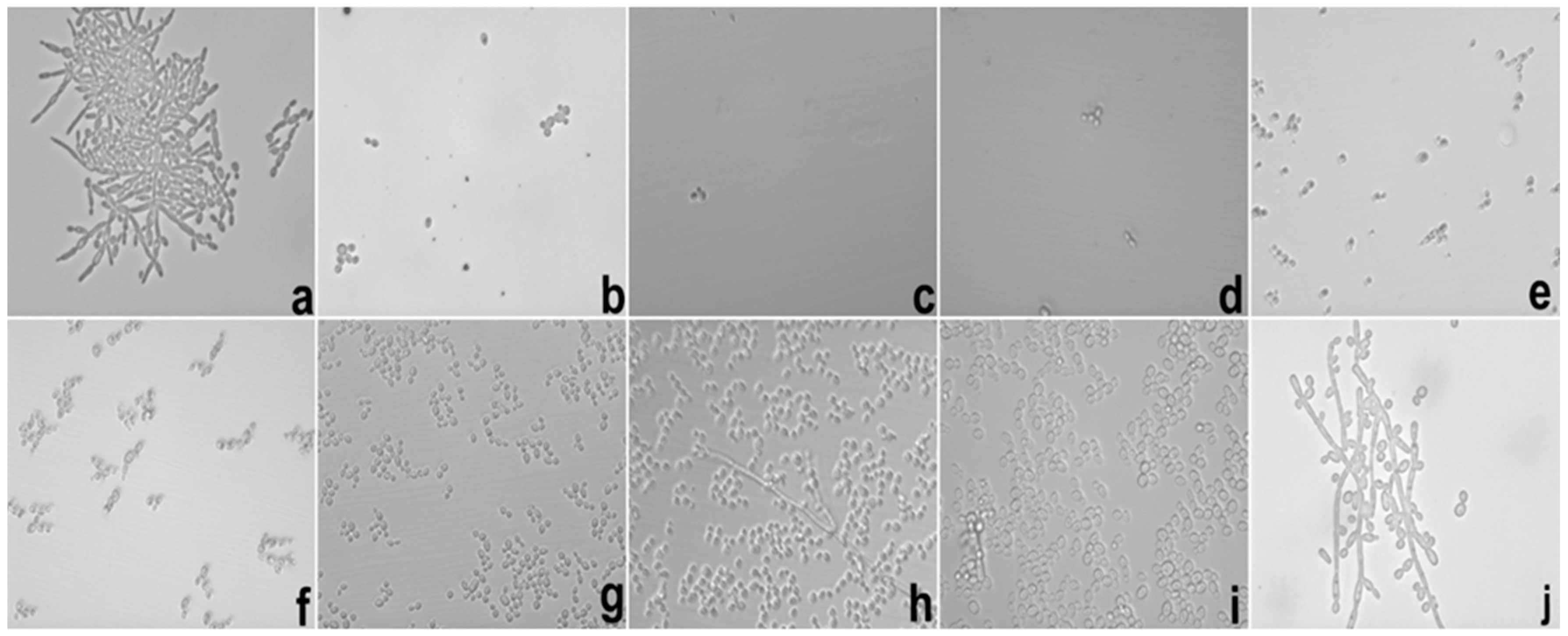 Ijms 17 01368 g008 1024