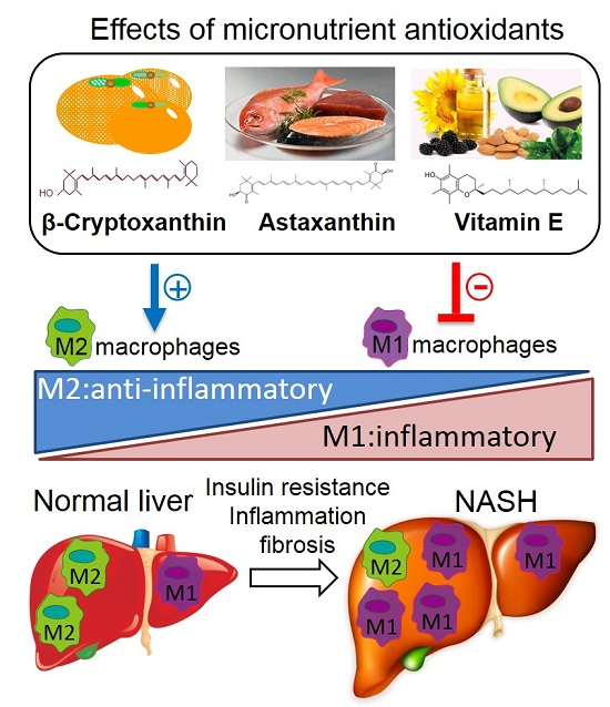 IJMS Free FullText Micronutrient Antioxidants and Nonalcoholic