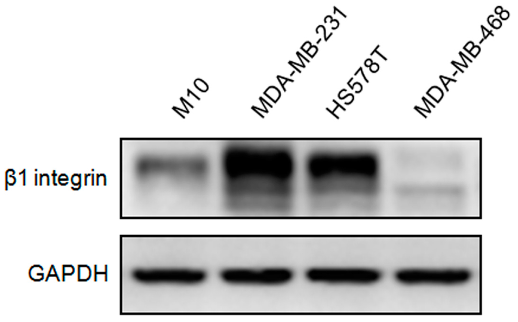 β1 Integrin as a Prognostic and Predictive Marker in Triple