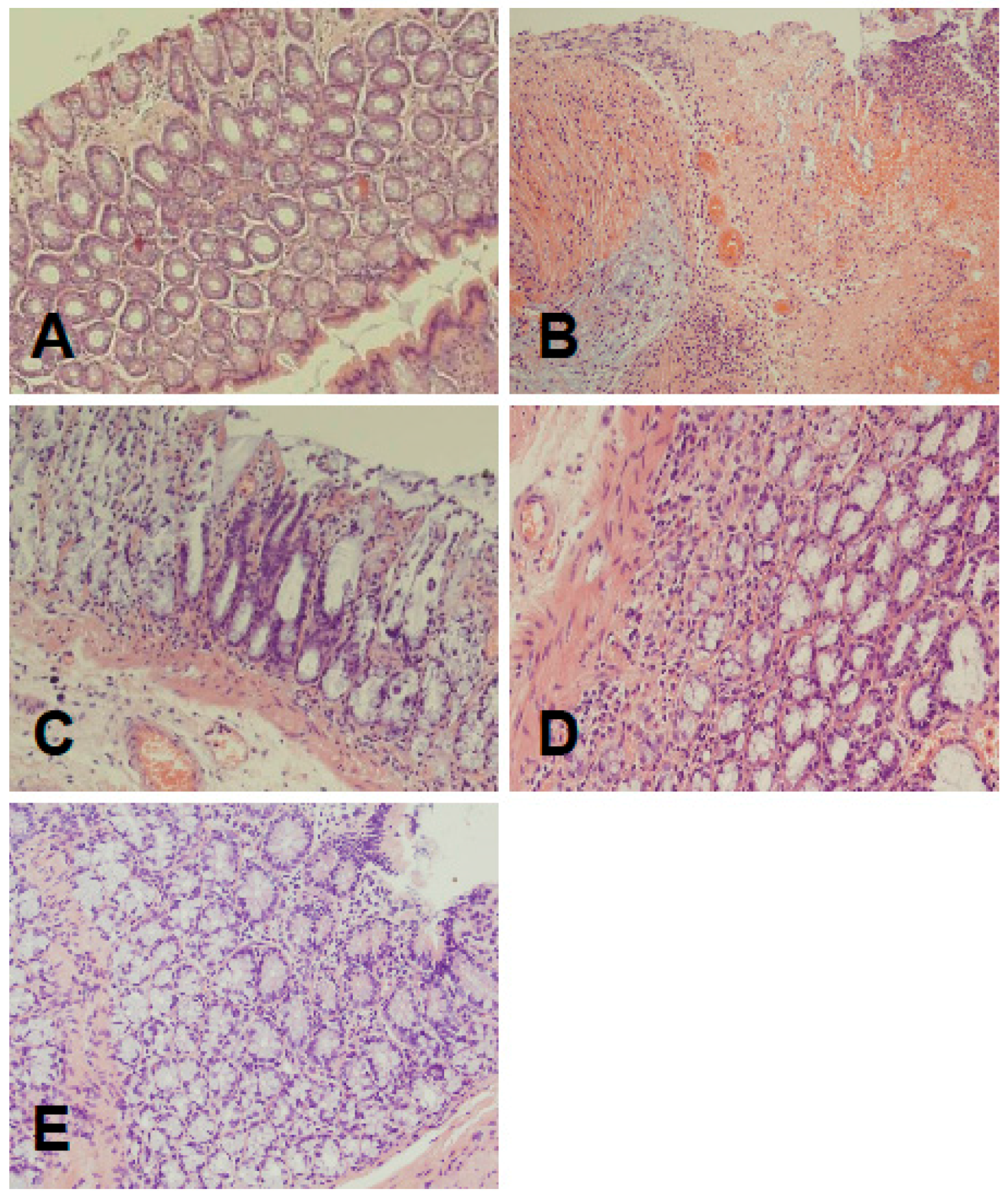 Ijms 17 01455 g002