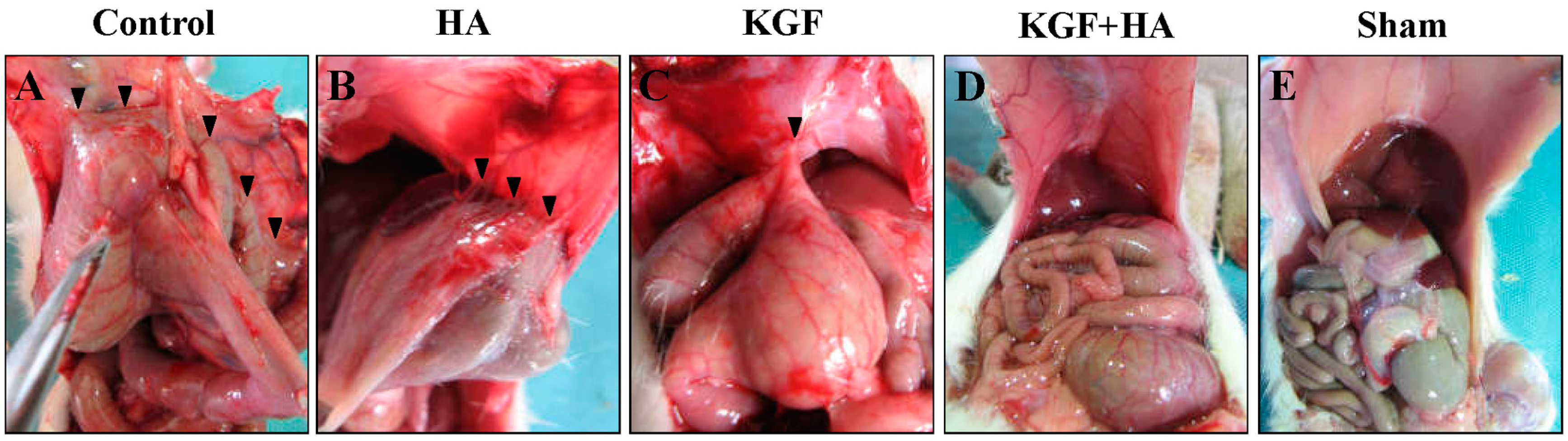 Adhesive disease Adhesive disease
