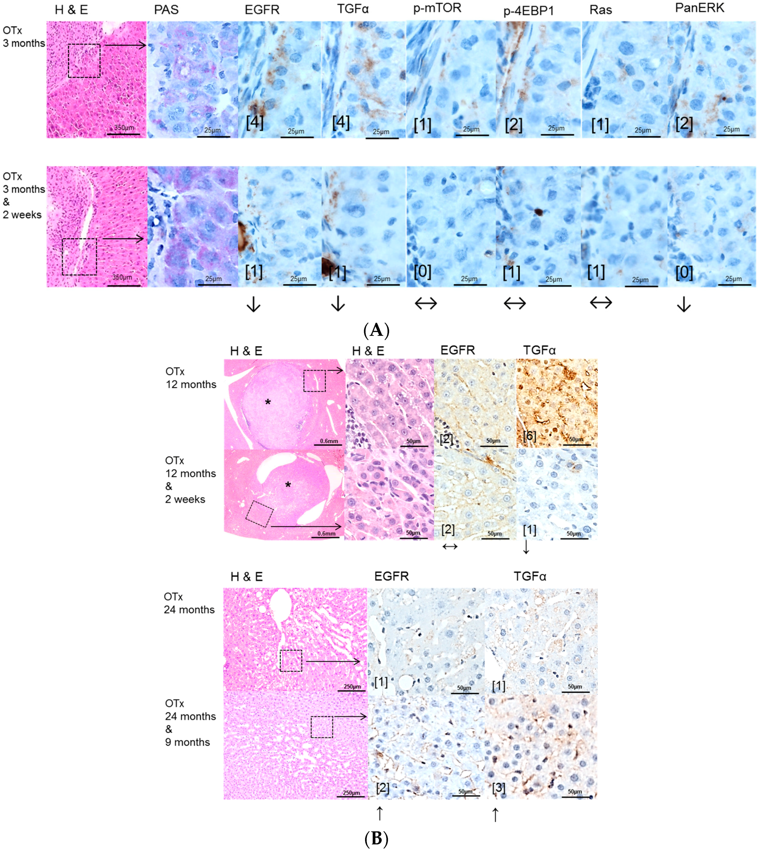 Ijms 17 01618 g003