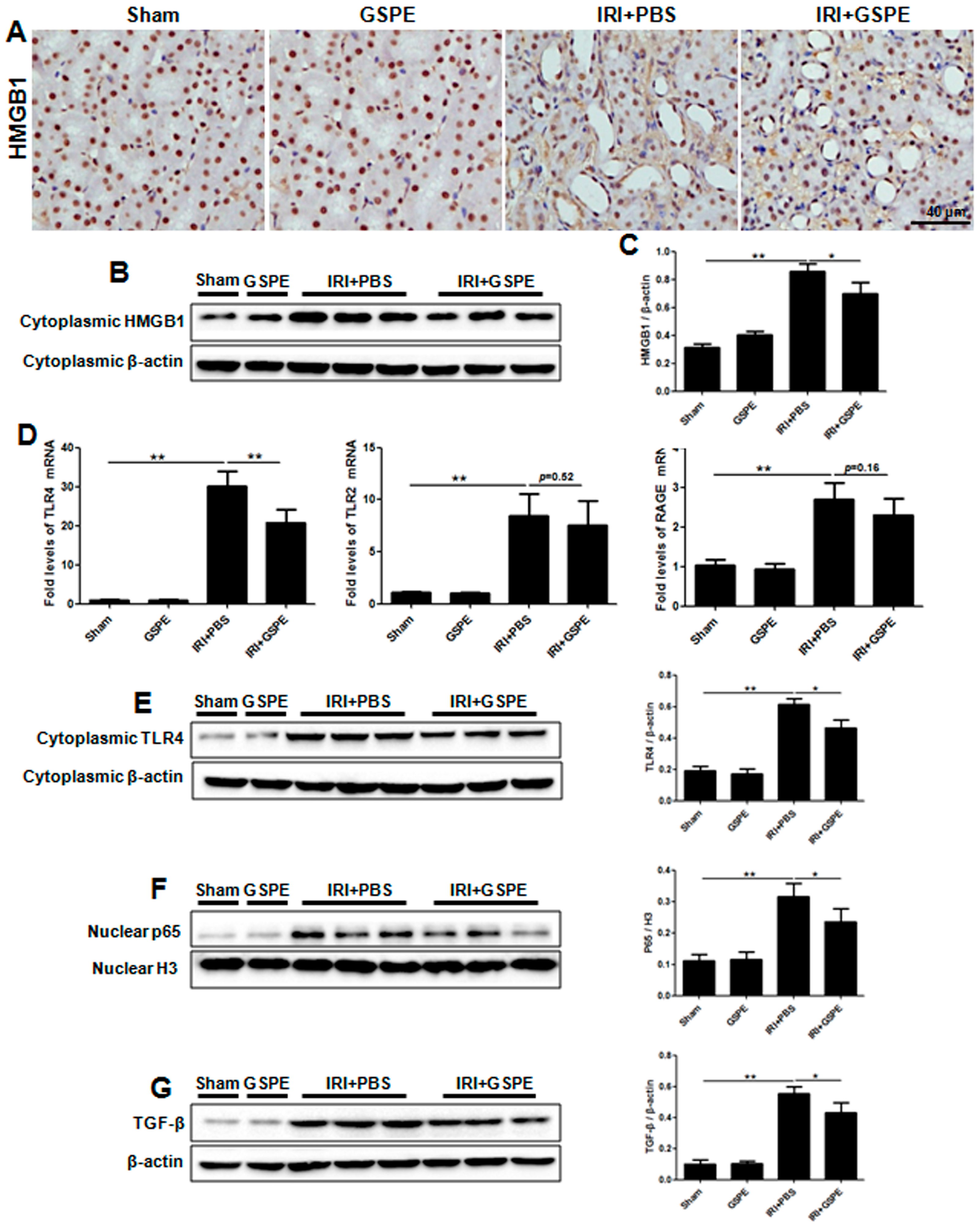 Ijms 17 01647 g007 550