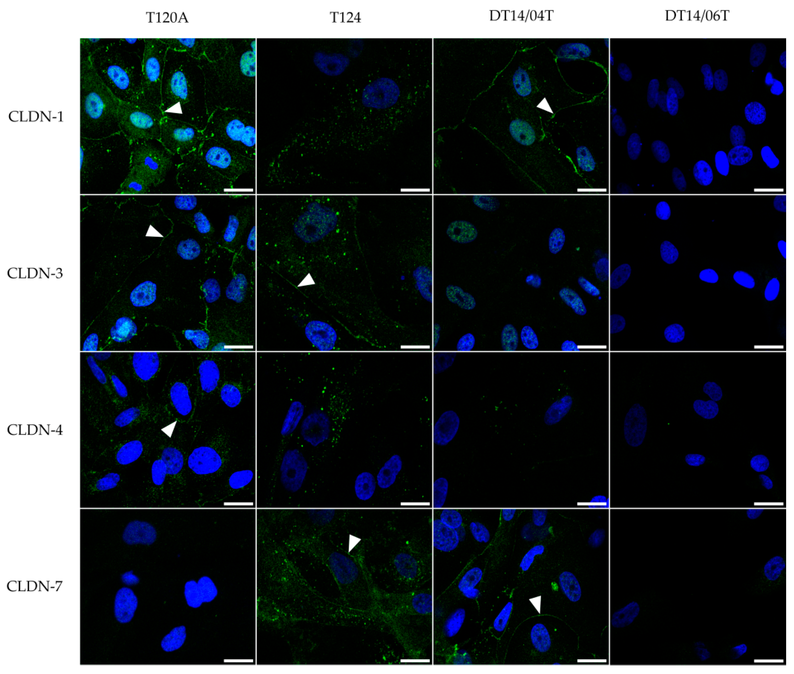 Ijms 17 01655 g004 550