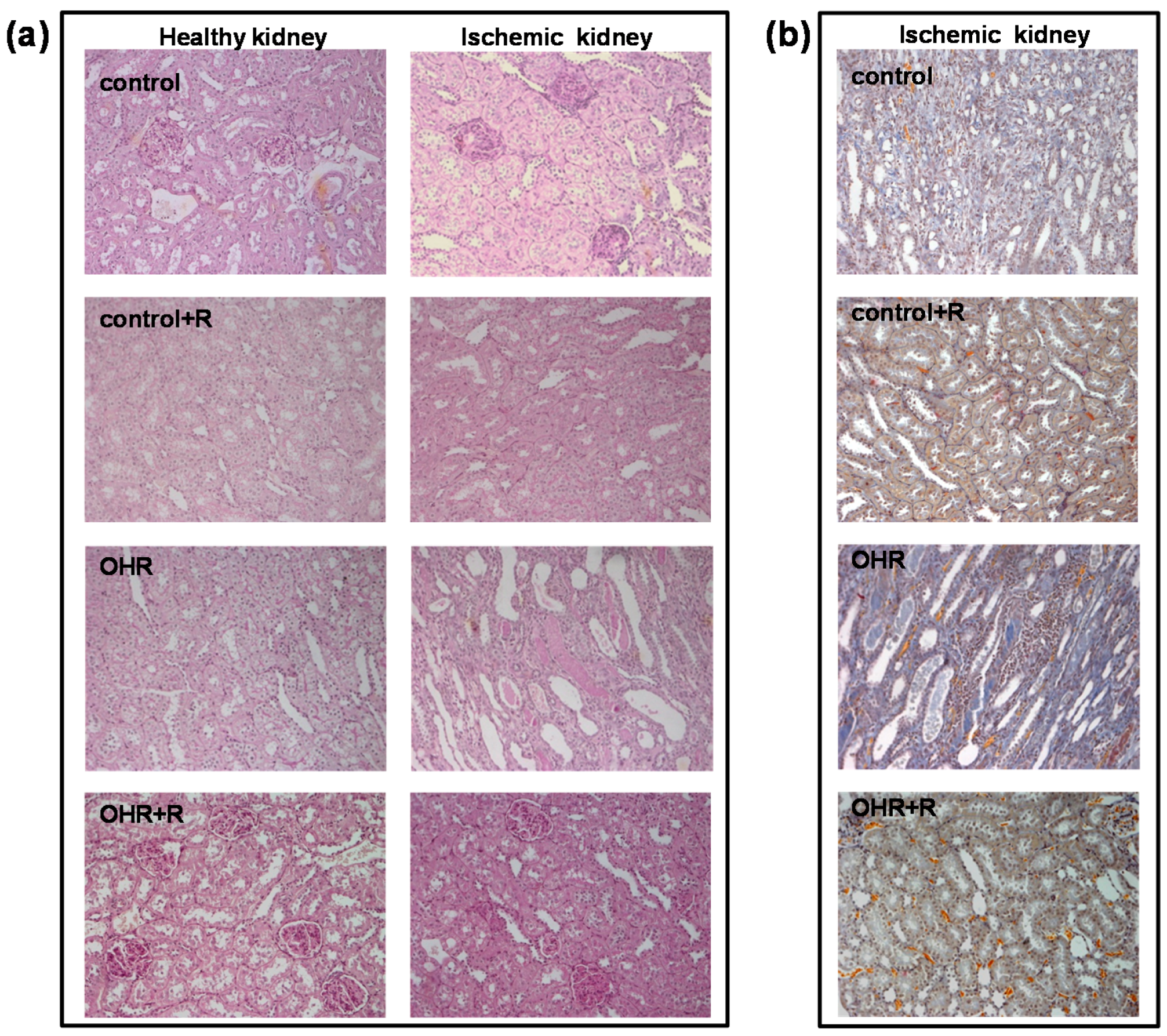 Ijms 17 01728 g005 550