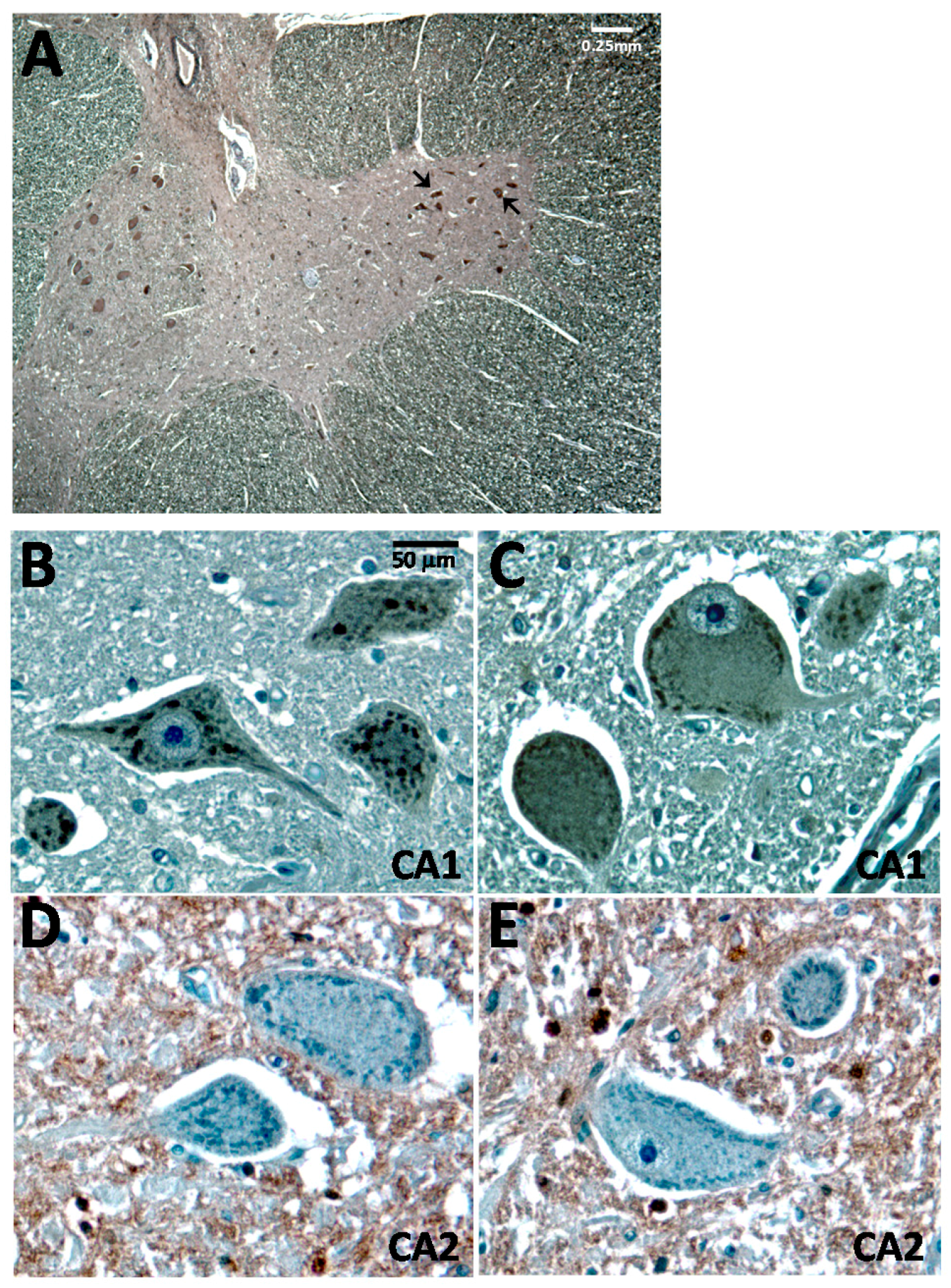 Ijms 17 01820 g001 550