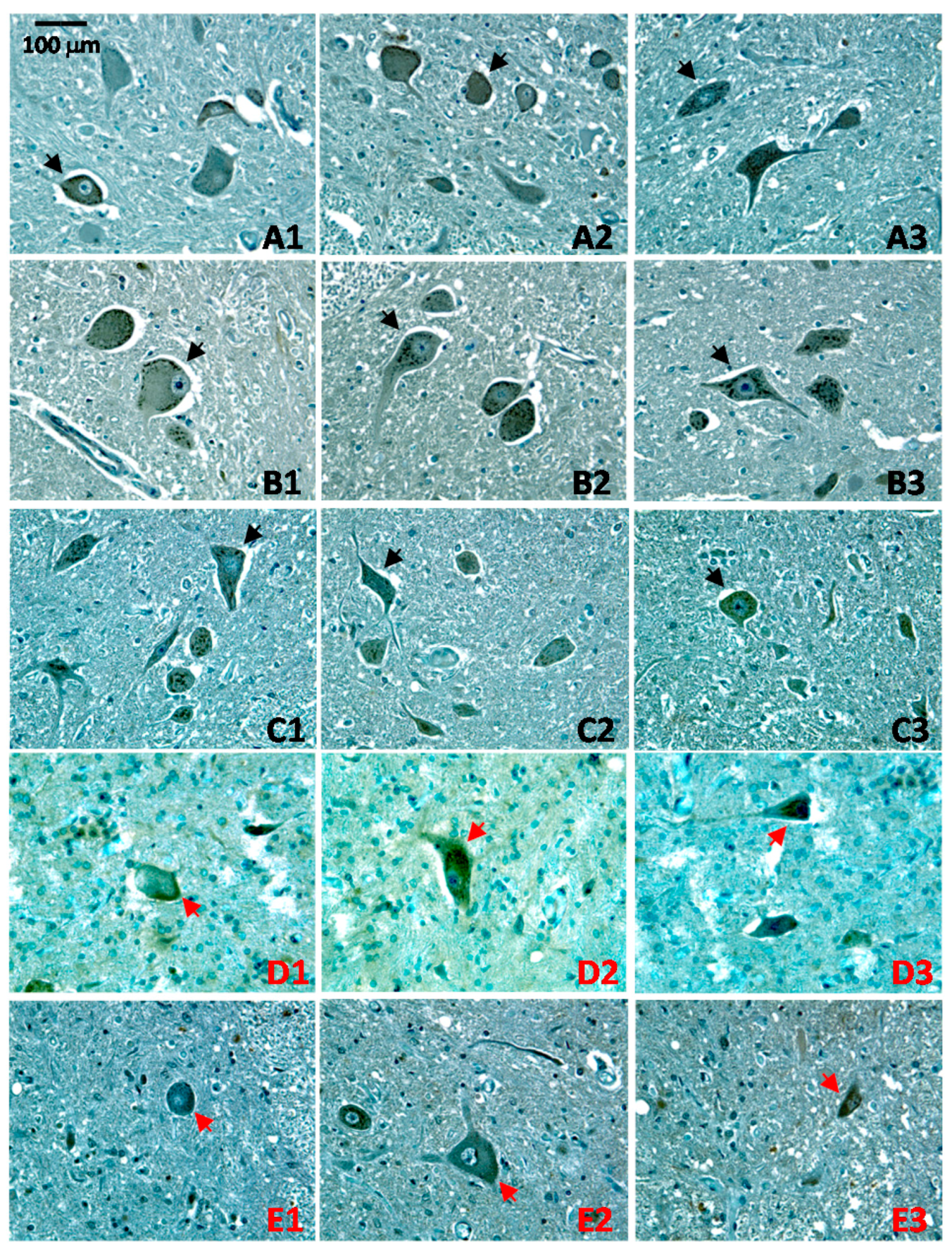 Ijms 17 01820 g004 550