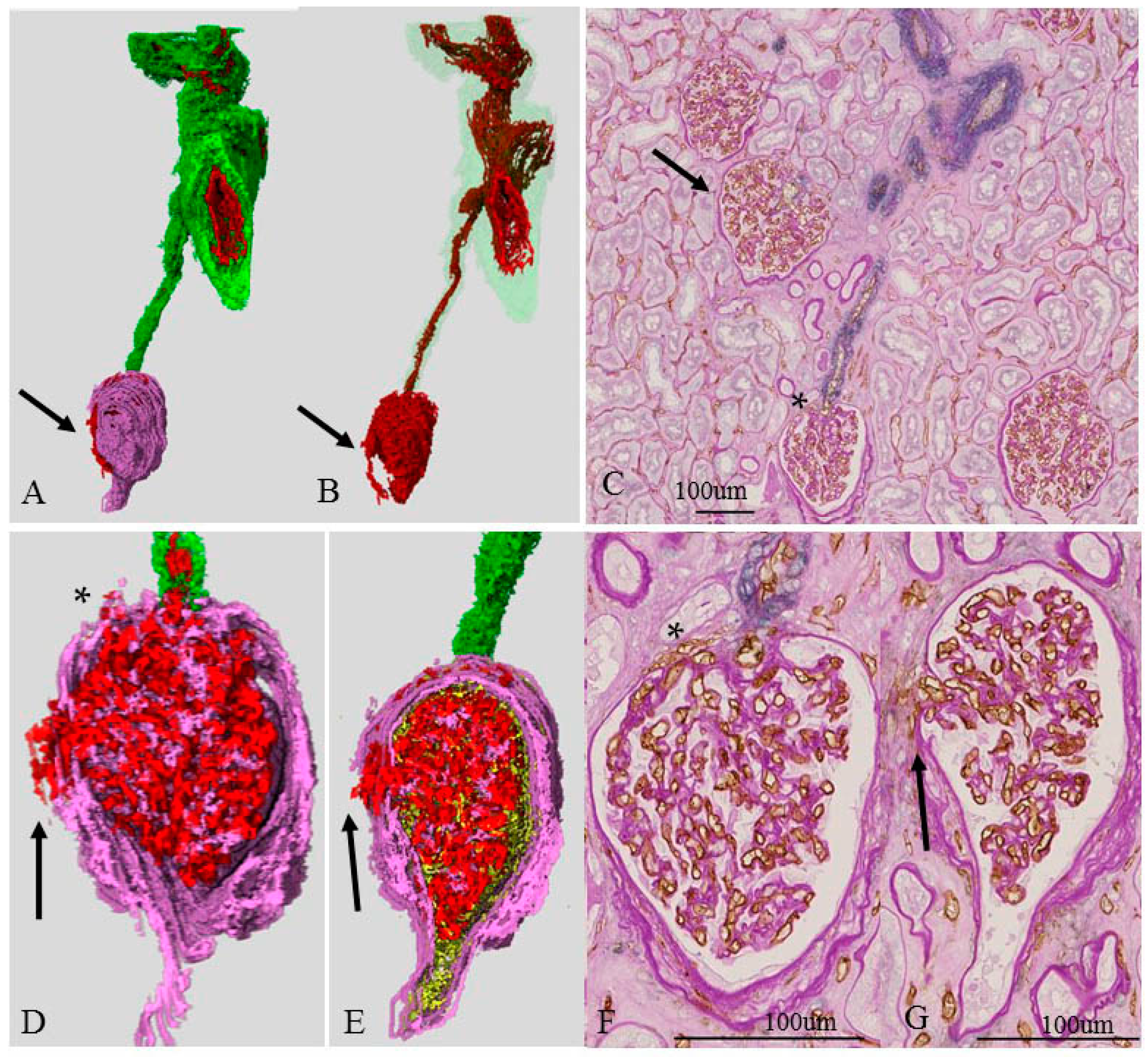 Ijms 17 01831 g005 550