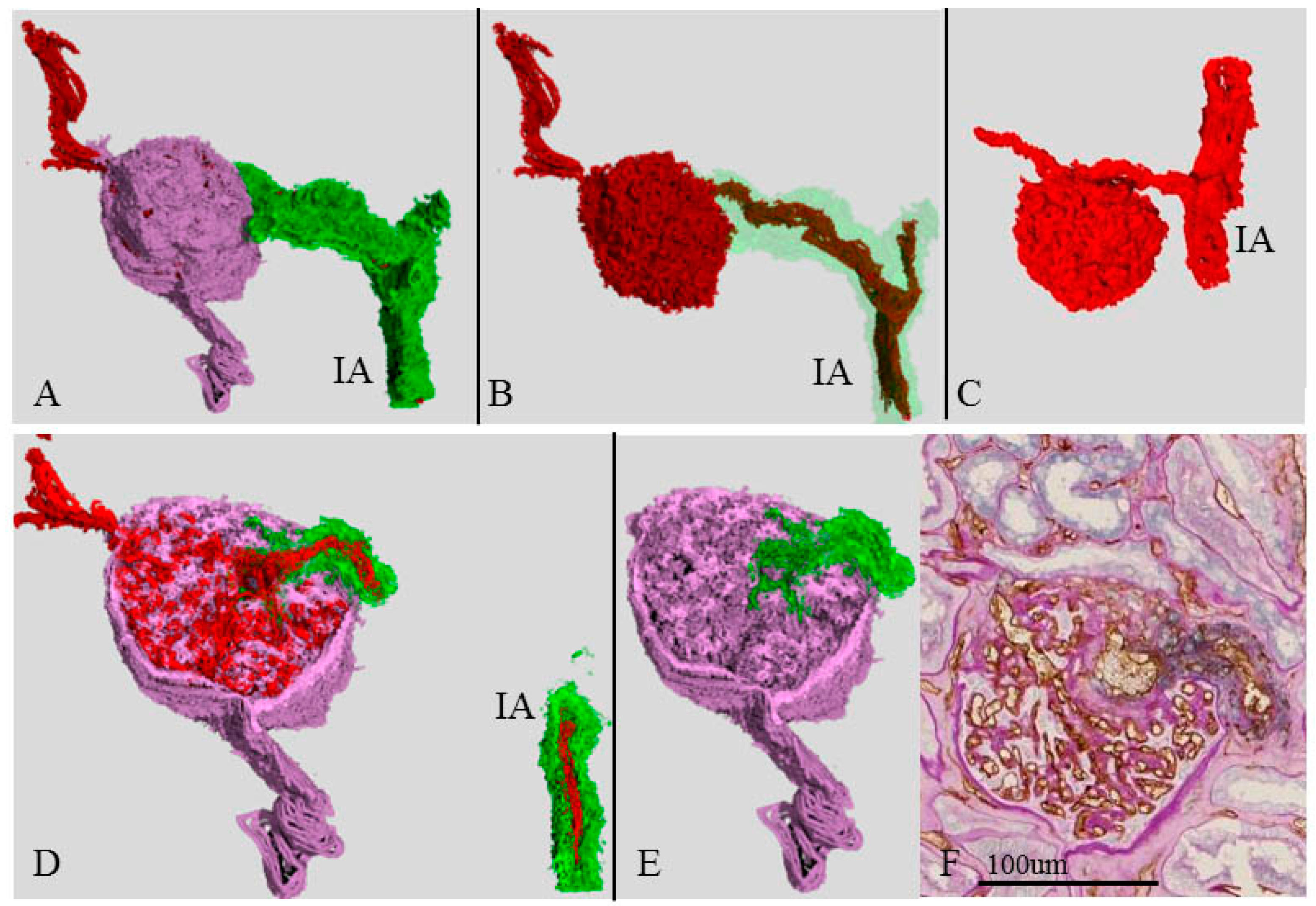 Ijms 17 01831 g006 550