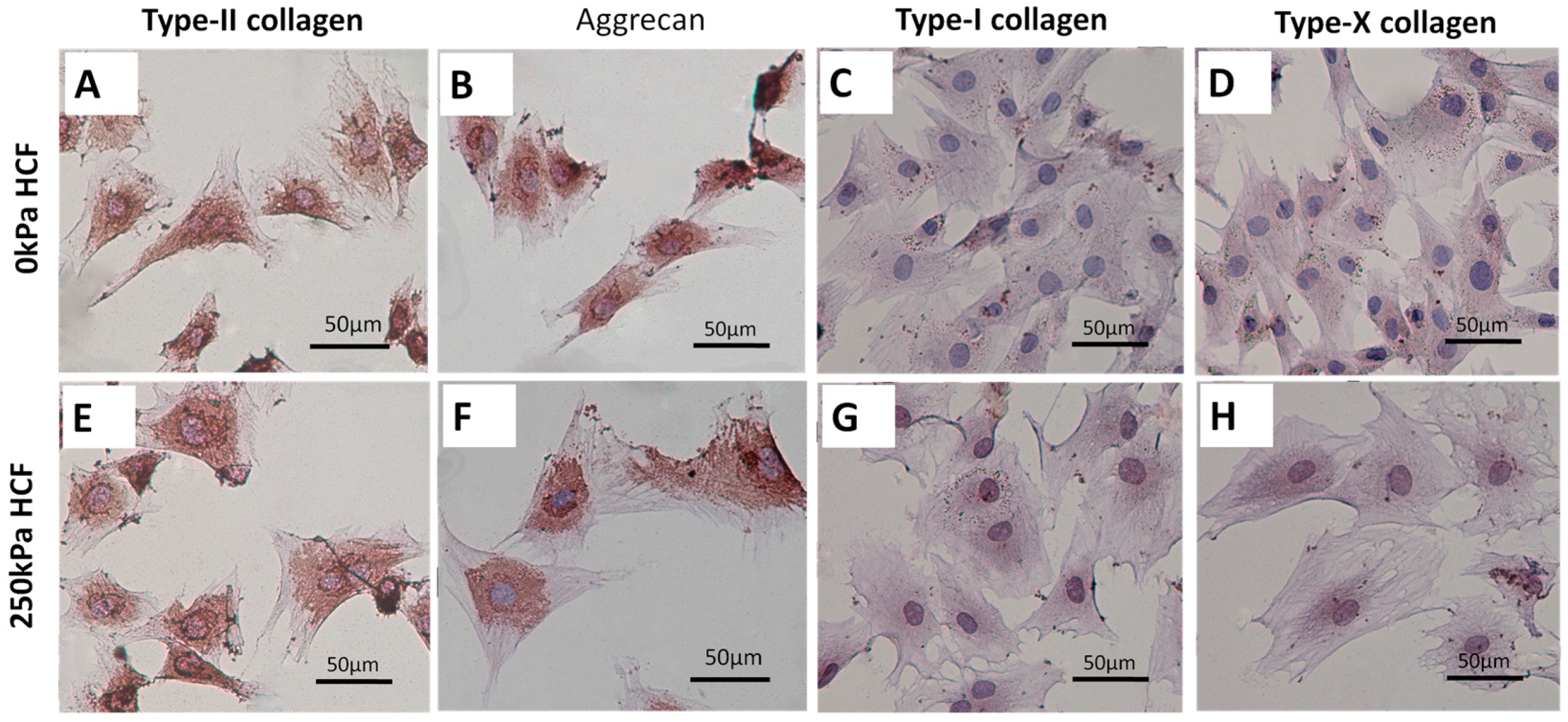 Ijms 17 01847 g005 550