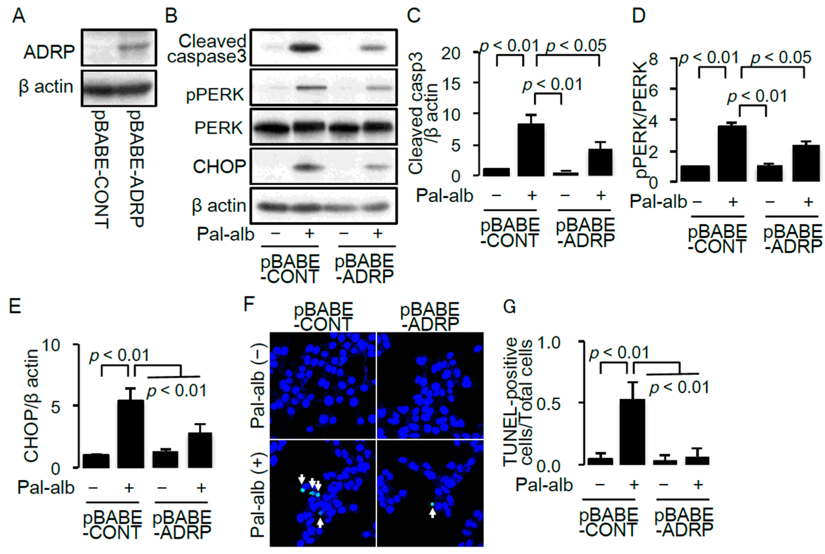 Ijms 17 01868 g005 550
